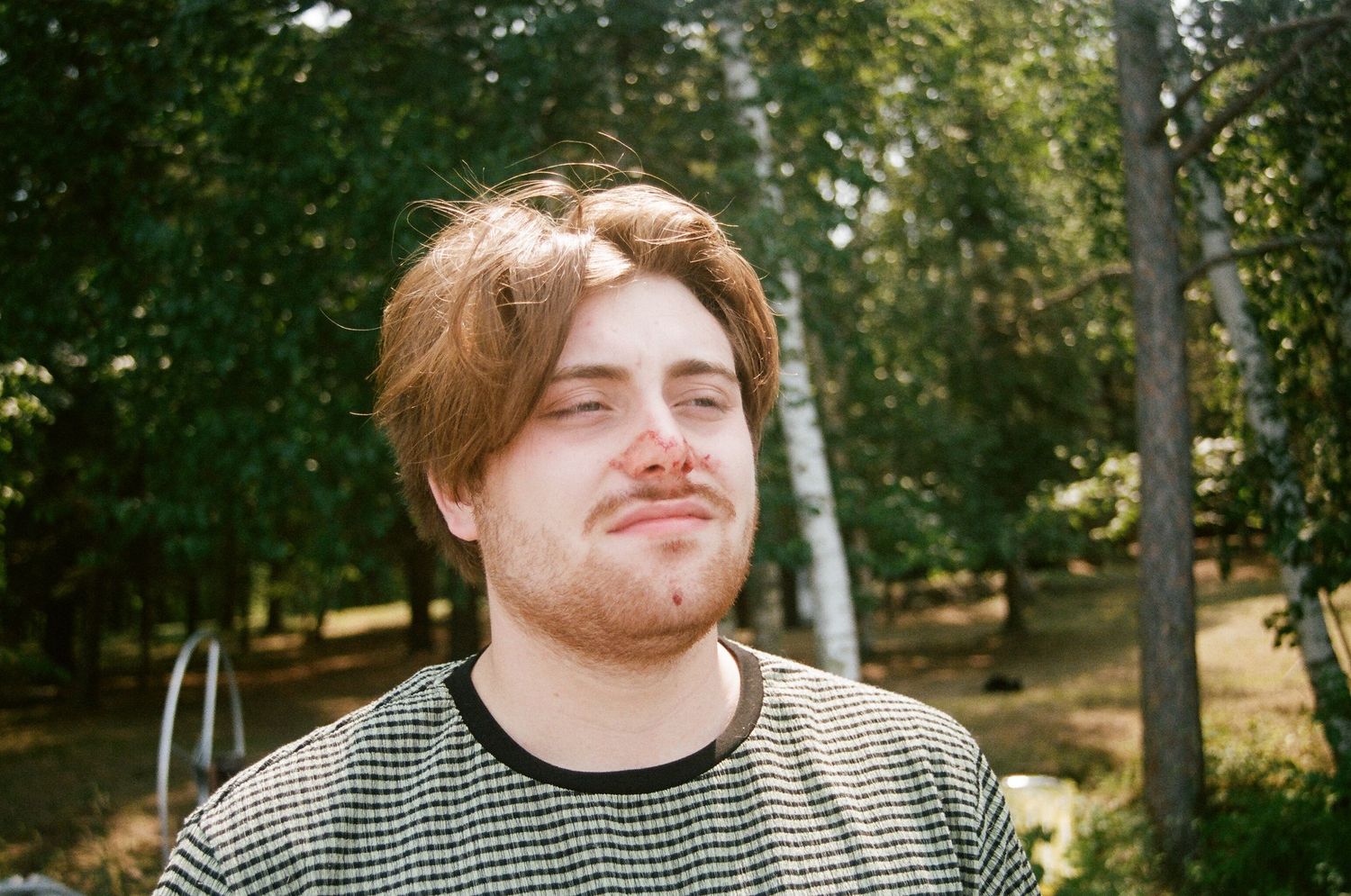 film photo of man with bloody nose
