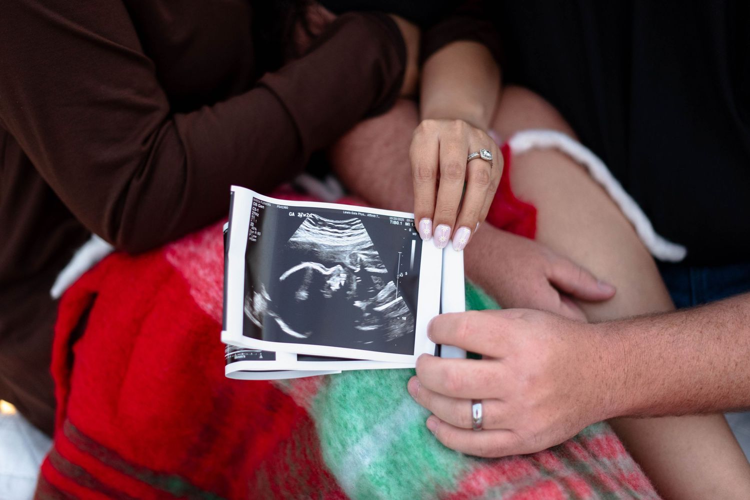 Parents holding an ultrasound during lifestyle session