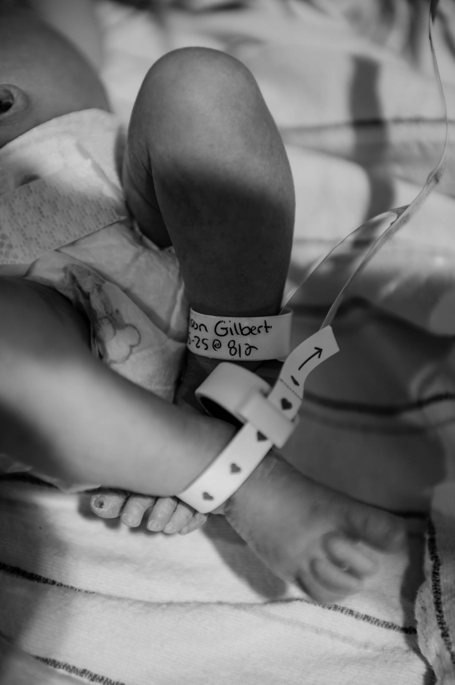 Black and white medical detail shot showing hospital equipment and patient care items.
