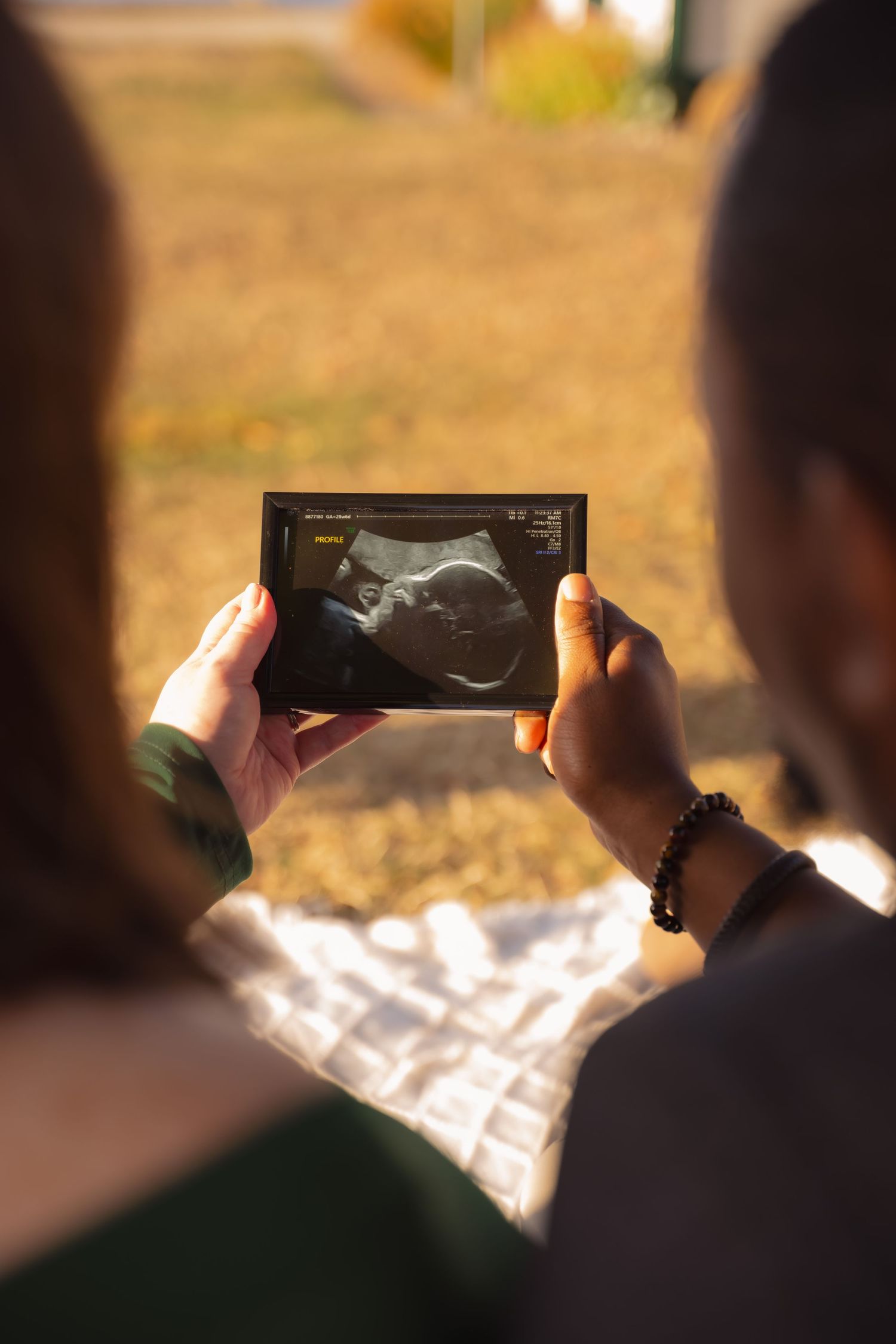 Someone holding up an ultrasound image against a warm sunset background creating a silhouette effect.