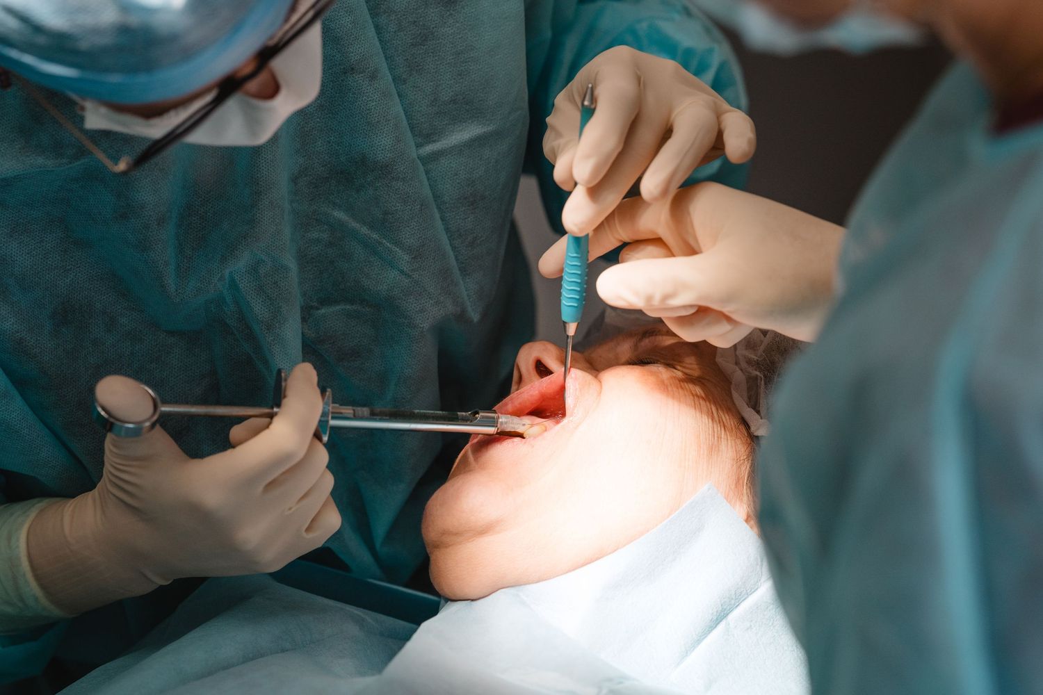 Dental surgeons performing oral surgery procedure on patient with mouth open, using dental tools and suction device.