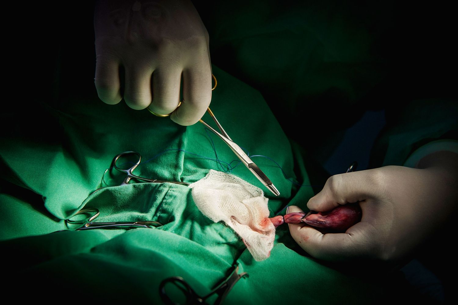 Surgical instruments and hands working during medical procedure under green lighting. Commercial photographer in Guelph Ontario