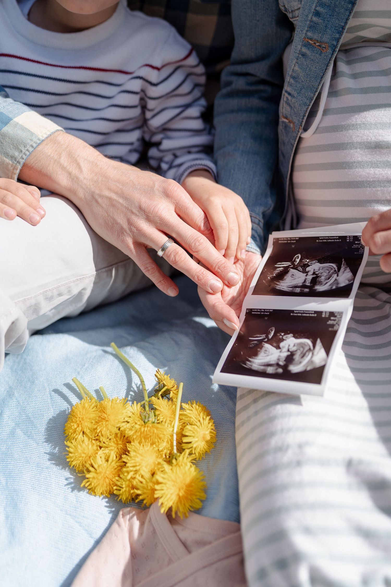 Yellow dandelions and ultrasound photos arranged on a light blue surface.