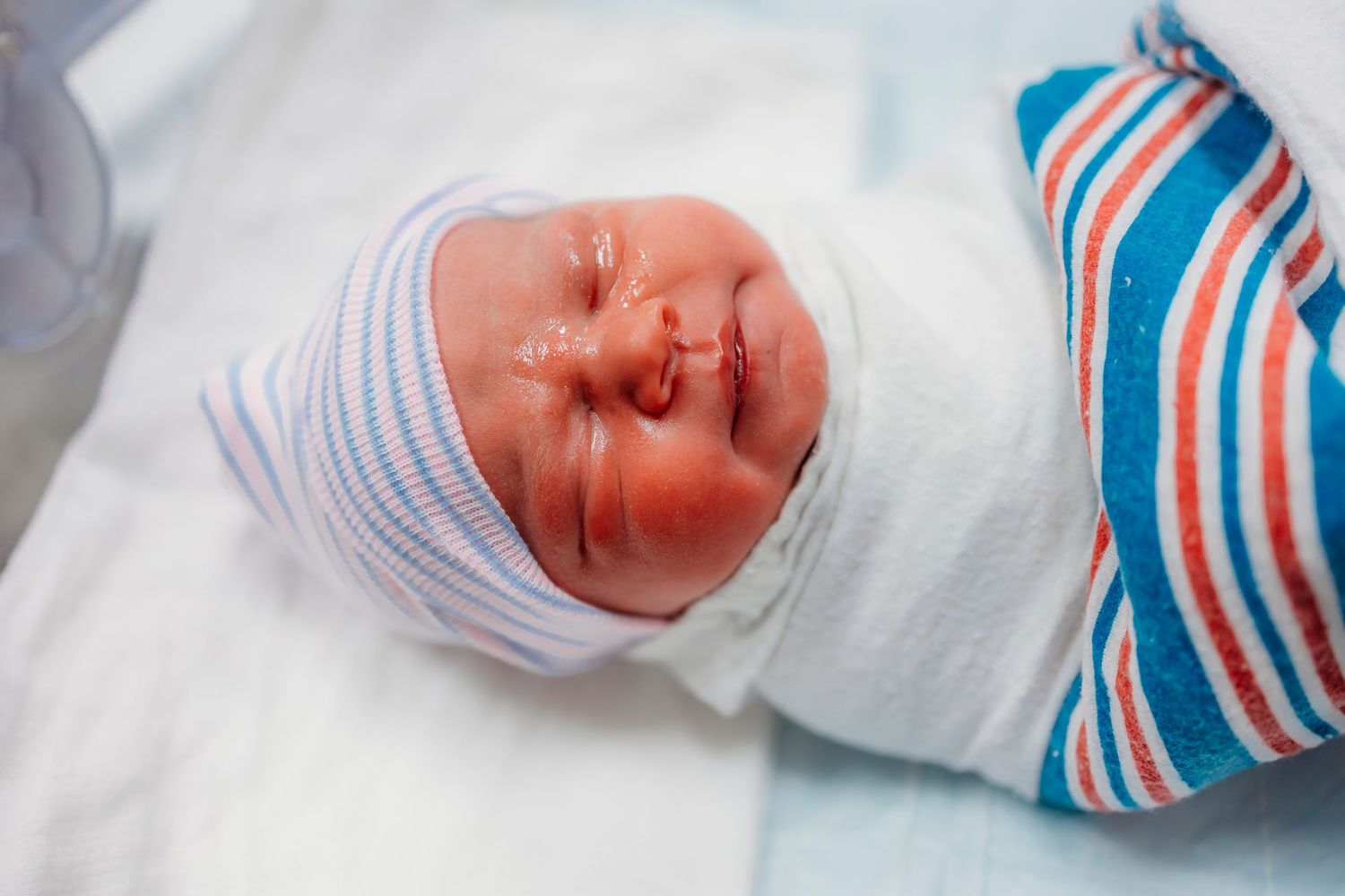 Close-up view of a newborn baby wearing a striped hospital hat in a medical setting.