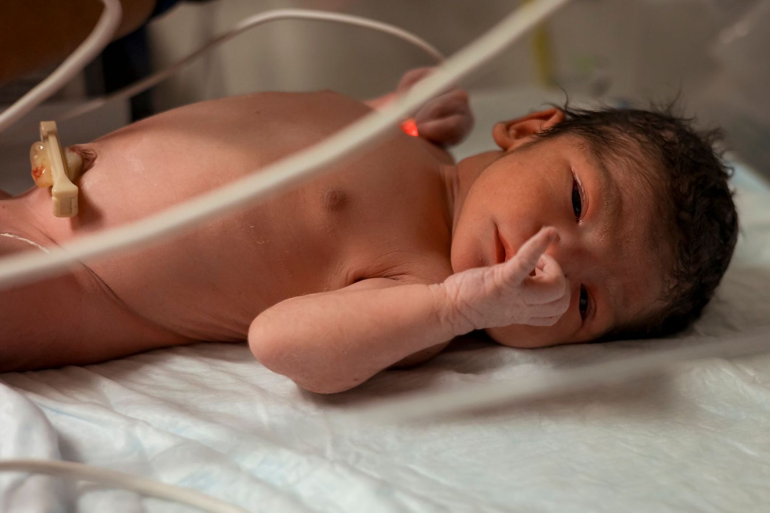 Close-up view of newborn baby resting on hospital bed.