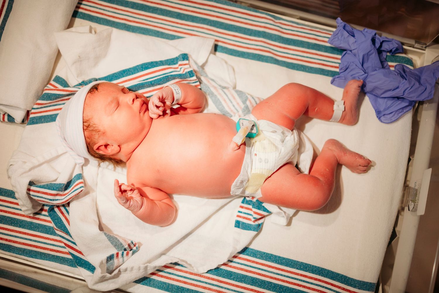 A newborn baby lies on striped hospital bedding during medical examination.