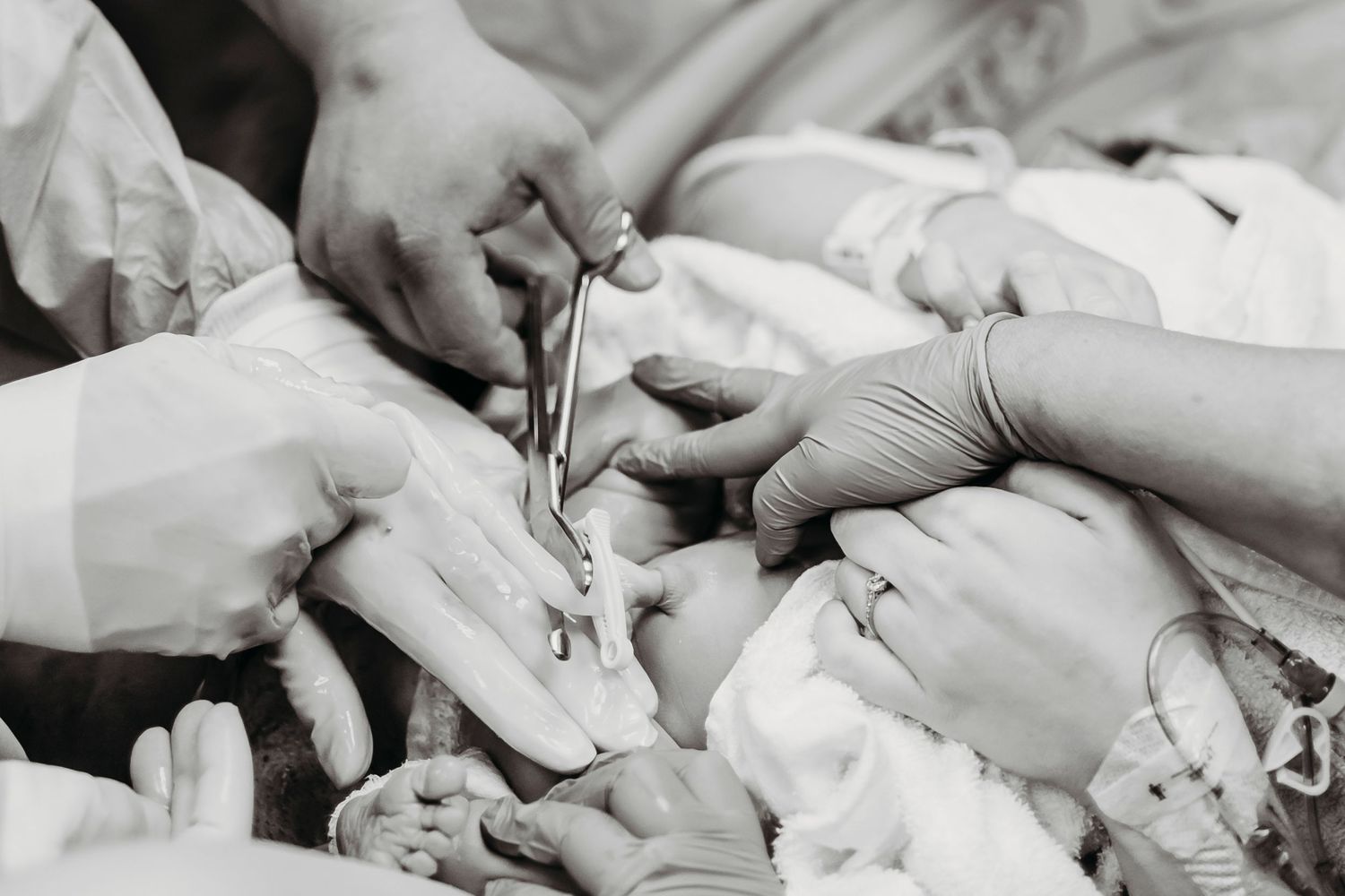 Medical staff performing a surgical procedure in black and white.