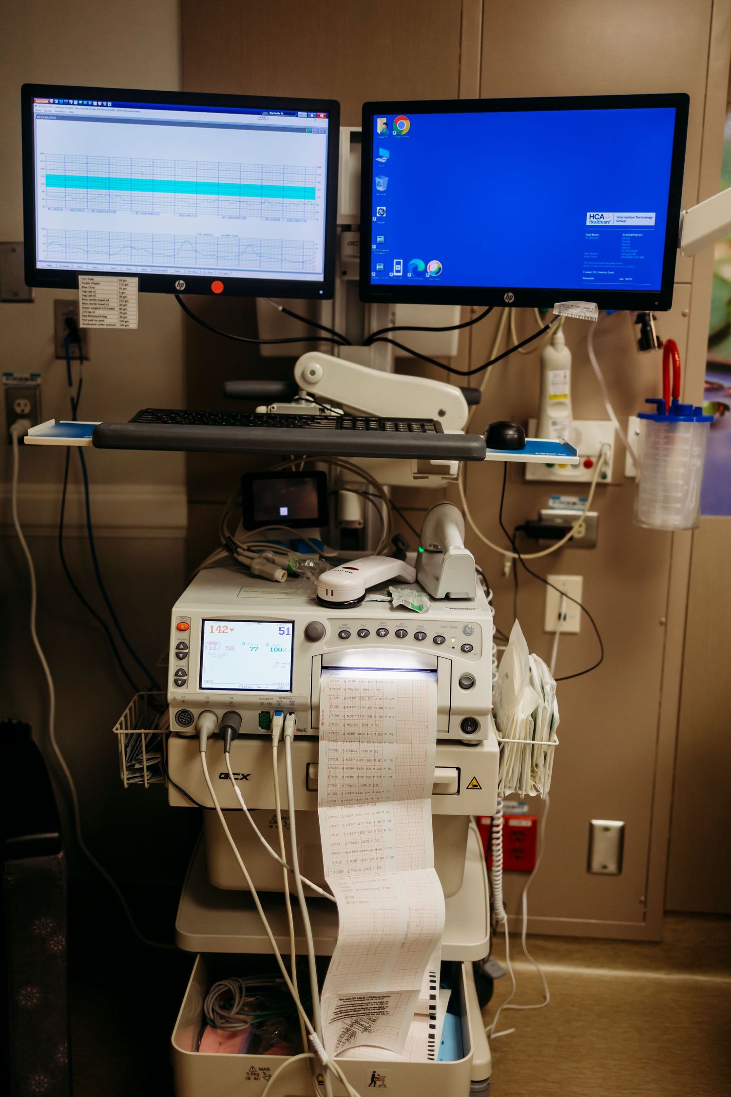 Multiple medical monitors and screens display patient data in a hospital setting.