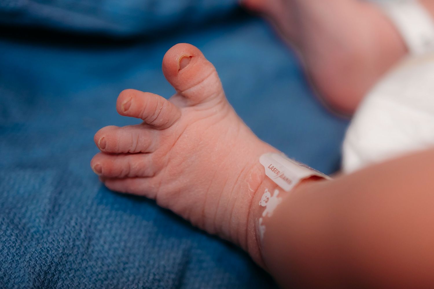 Close-up of a newborn baby's foot with medical tape.