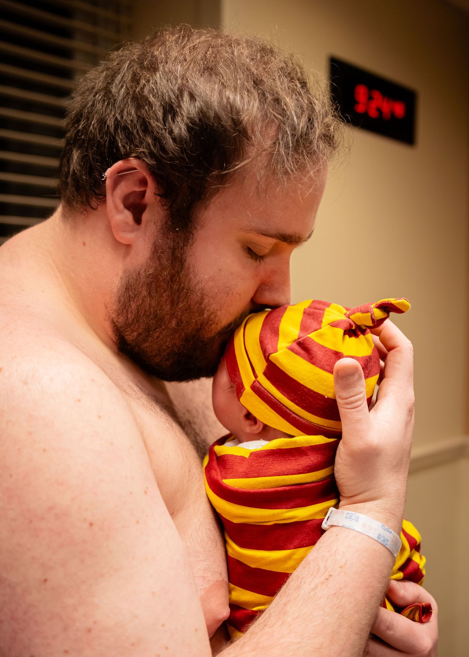 A bearded father kisses his newborn baby wrapped in red and yellow striped hospital blanket during skin-to-skin bonding.