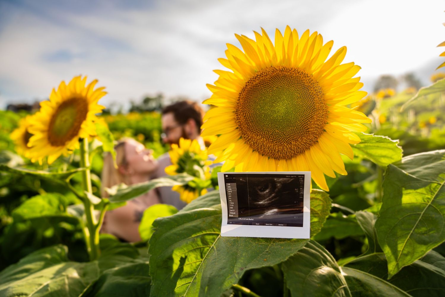 Couple lying in a sunflower field with an ultrasound photo in the foreground.