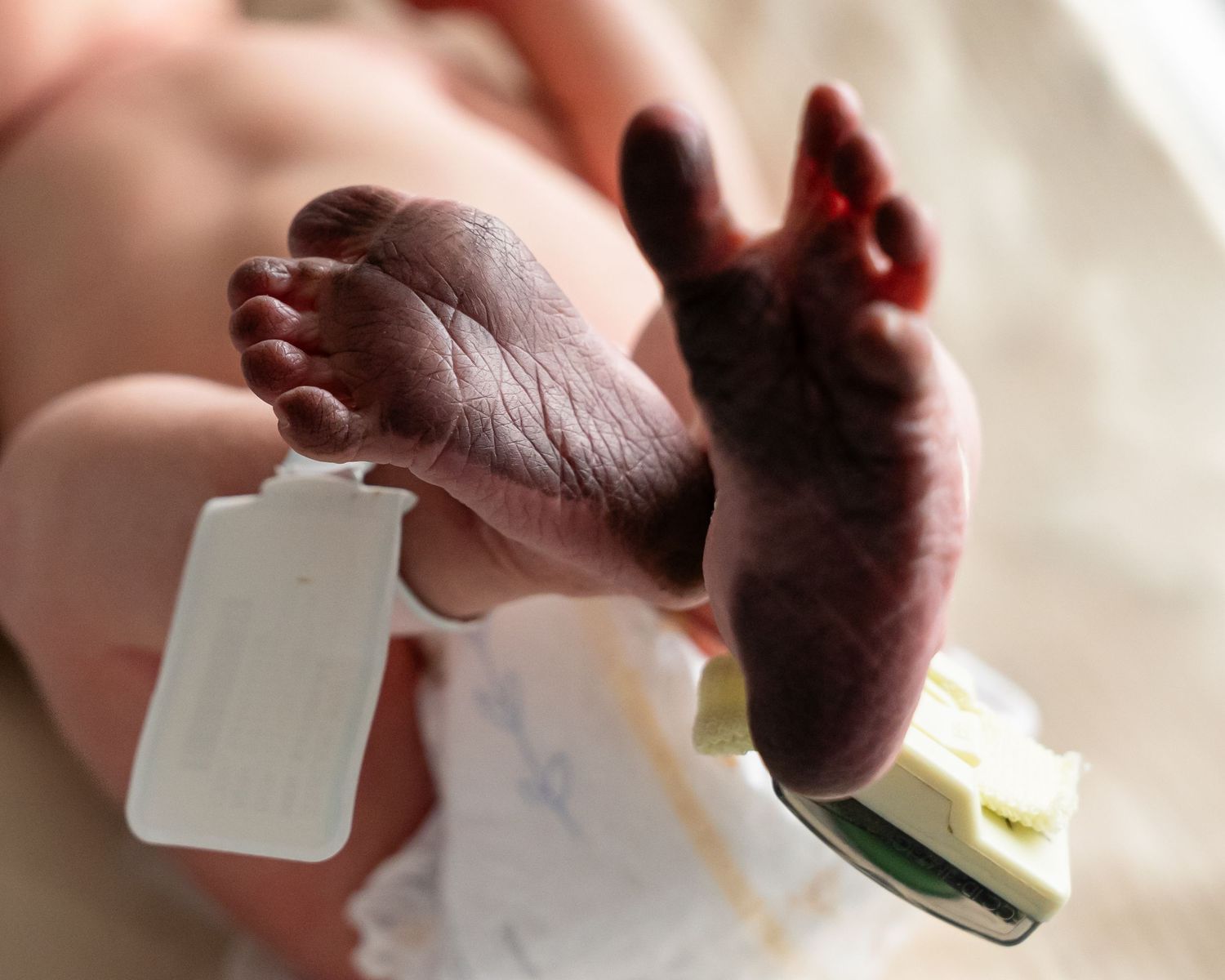 Newborn baby feet with hospital ID tag and medical monitor attached in a clinical setting.
