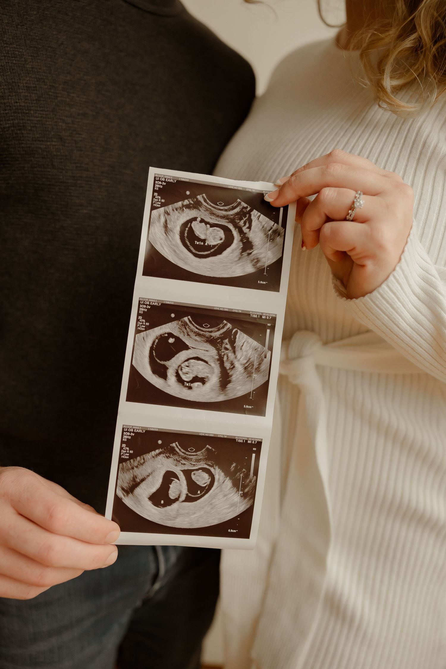 Hands holding ultrasound images showing stages of pregnancy in black and white film strip style photos.