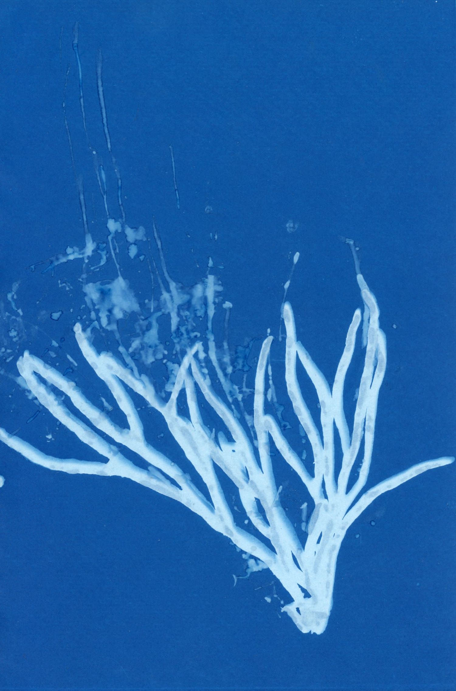 X-ray image sequence showing progressive stages of a hand movement in blue tones against a dark background.