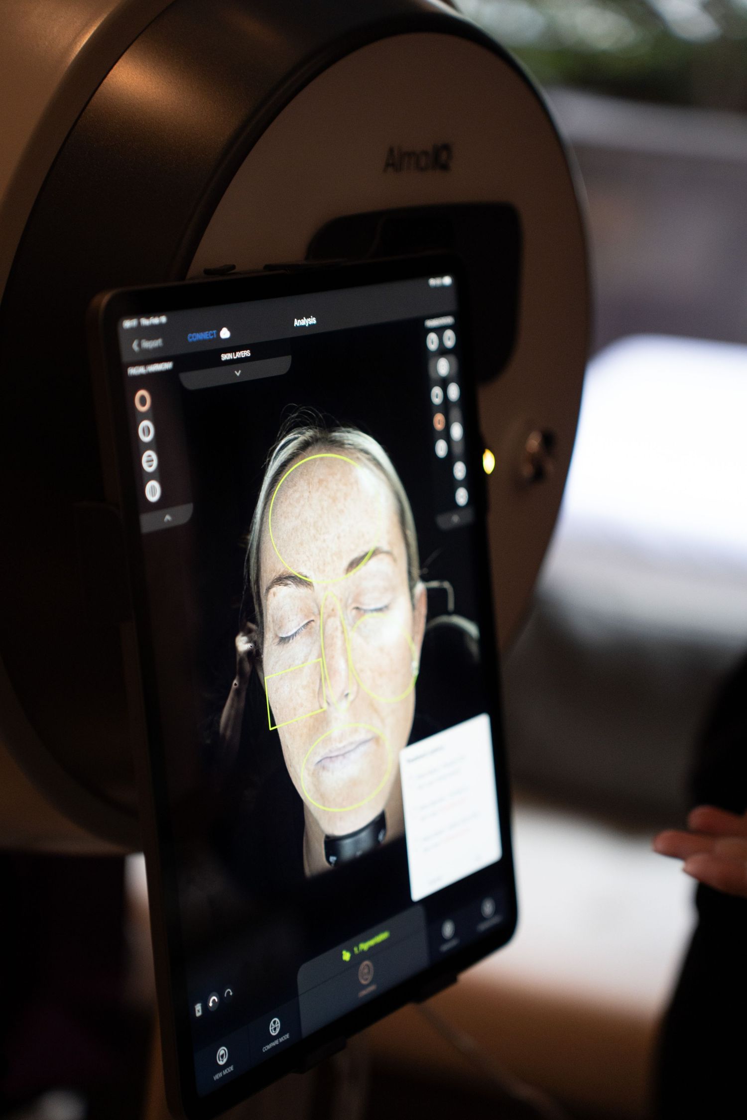 Alma IQ skin analysis device screen showing detailed facial scan with texture analysis of a blonde woman.