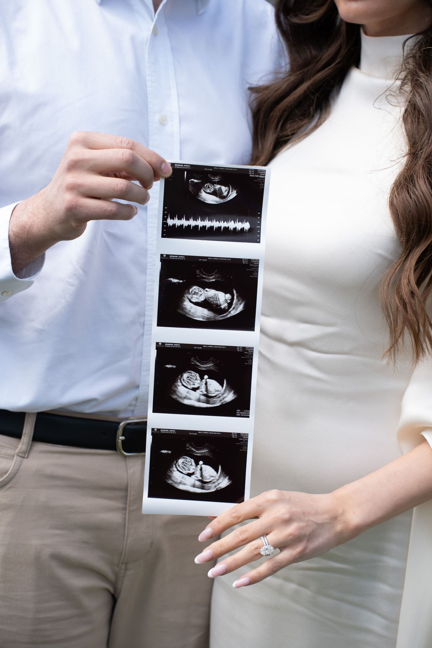 Pregnant couple holding ultrasound sonogram images, woman in white dress with engagement ring, man in blue shirt.