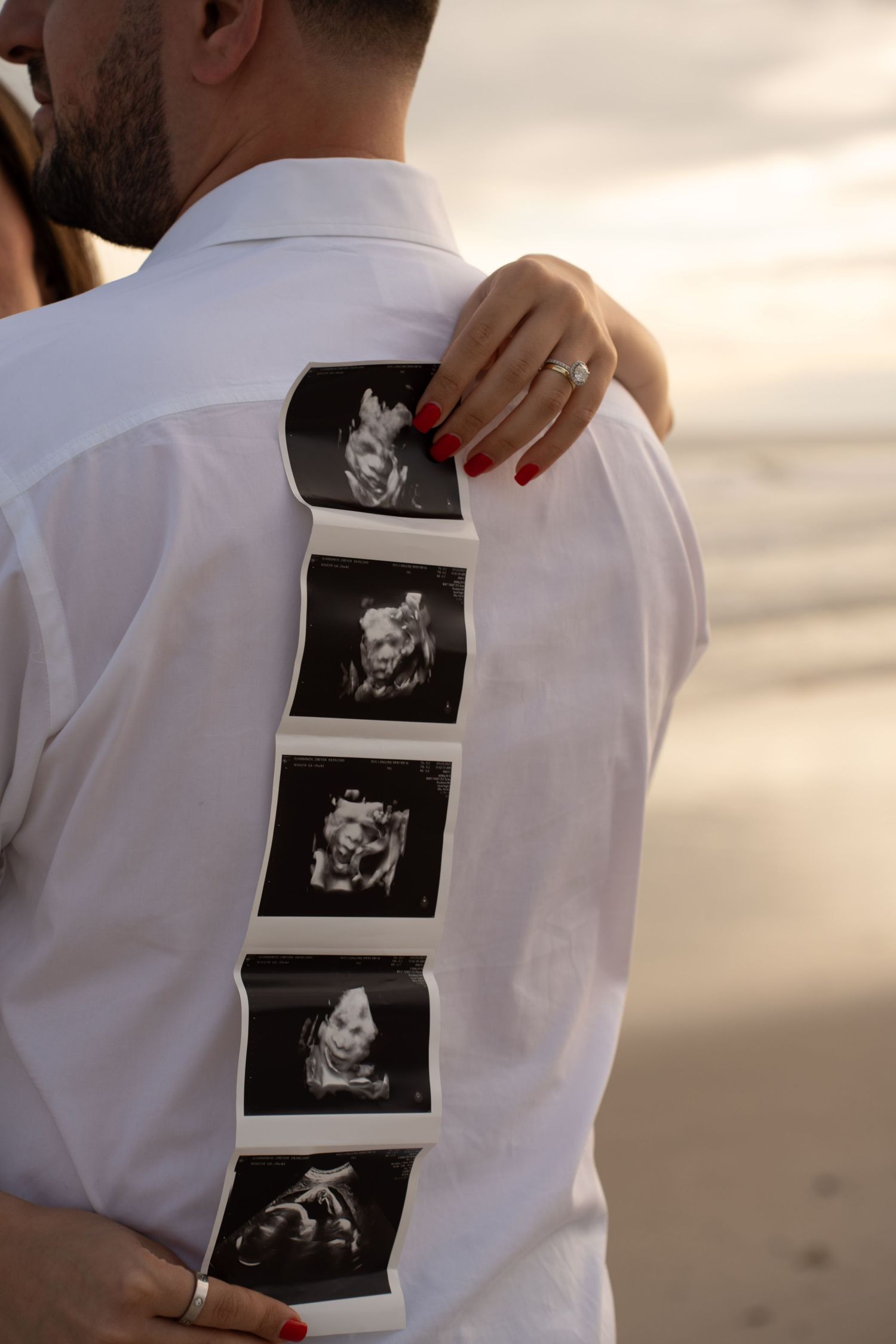 Couple embracing on beach with ultrasound photos displayed on man's white shirt, woman wearing engagement ring.