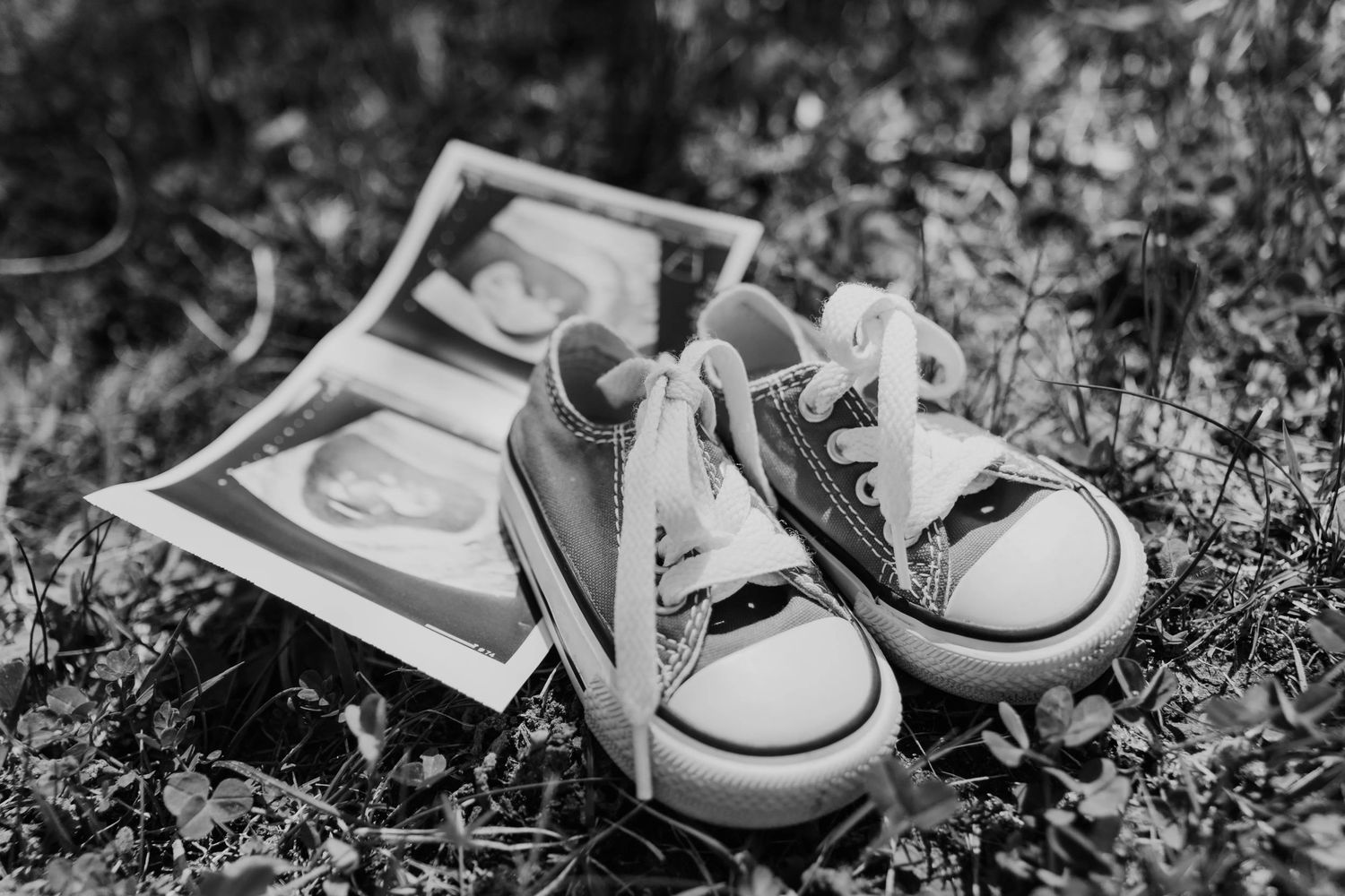 Black and white photo of baby shoes arranged in grass with ultrasound image in the background.