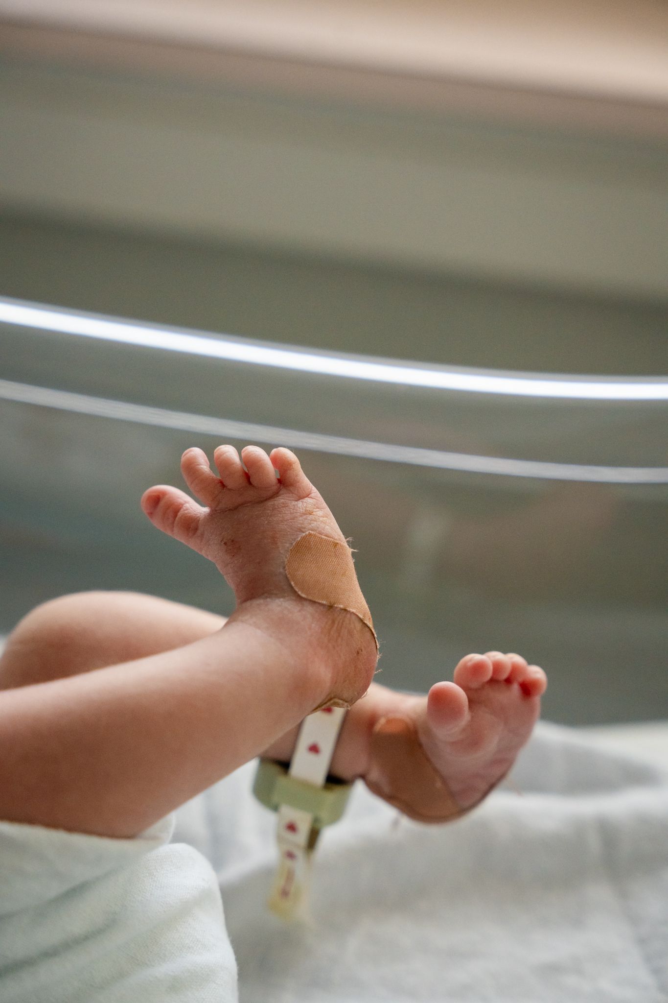 Tiny newborn feet with hospital ID bracelet against white background.