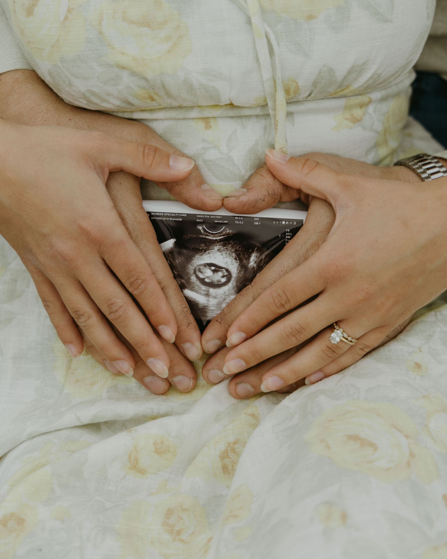 Close-up view of hands holding a sonogram ultrasound photo against a white background.