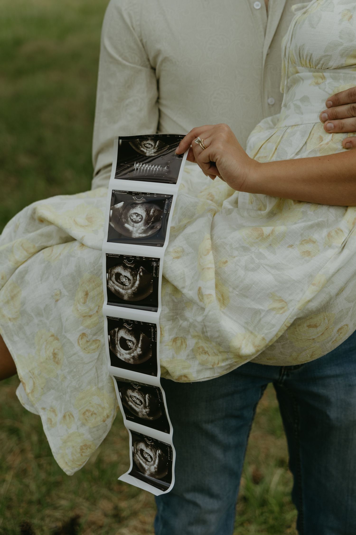 Multiple ultrasound images displayed in sequence showing early pregnancy stages.
