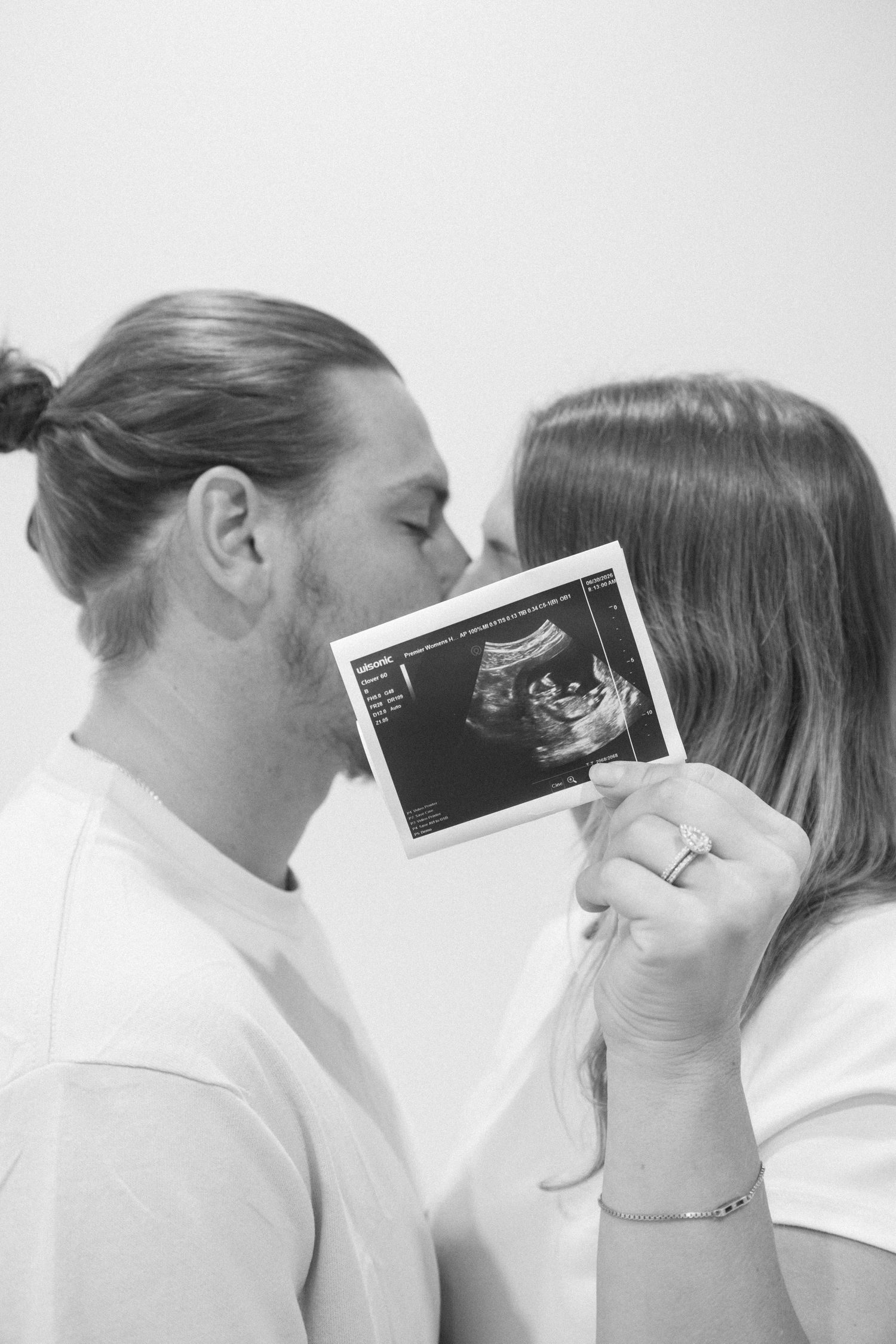 Black and white photo of a couple kissing while holding an ultrasound scan, announcing their pregnancy.