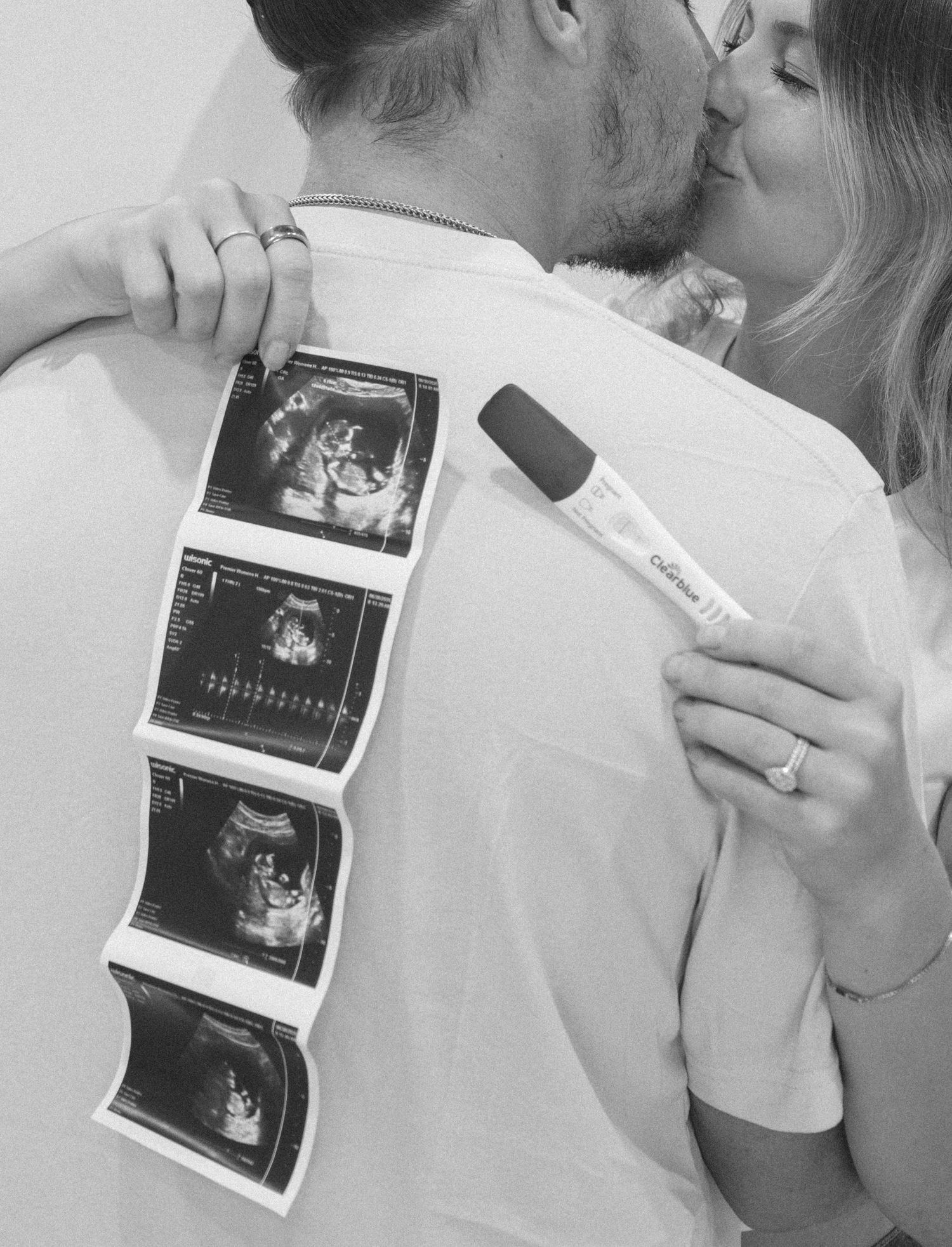 Black and white photo of a couple kissing while holding ultrasound scans and a pregnancy test.