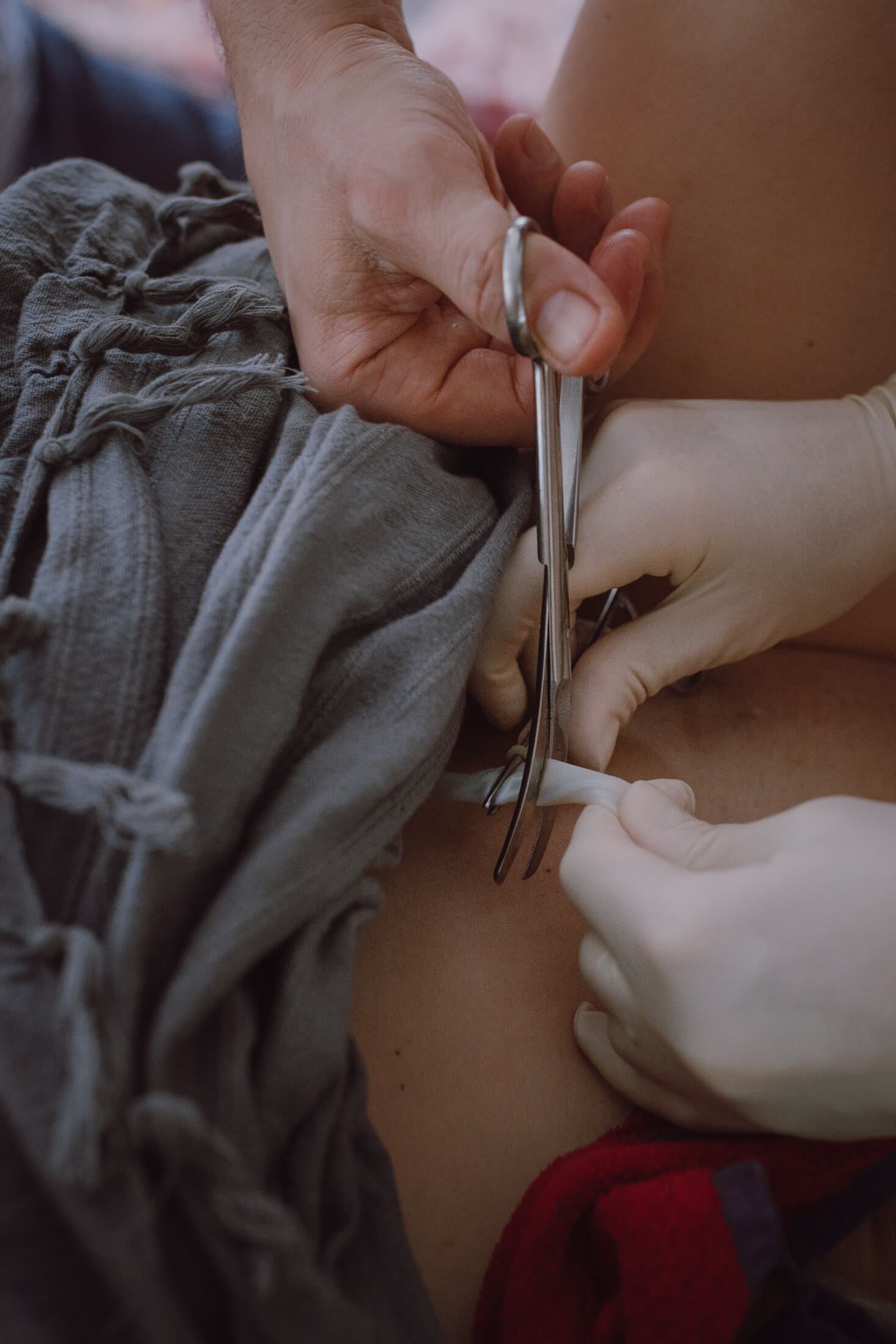 Medical tools being handled during a birthing procedure.