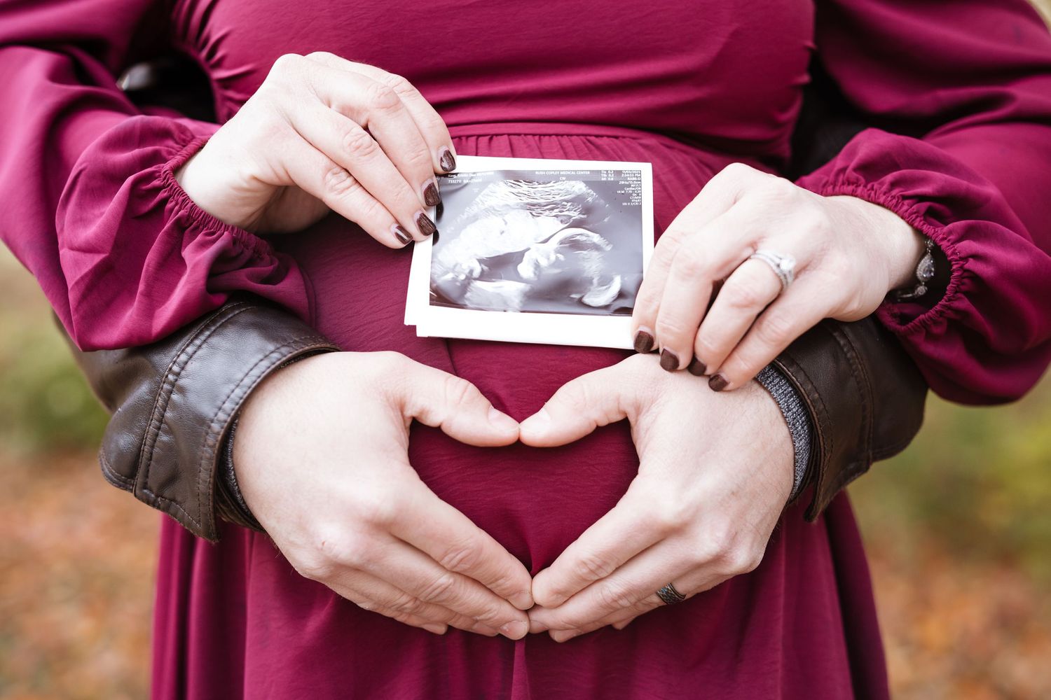 Couple forms heart shape with hands over pregnant belly while holding baby ultrasound photo.