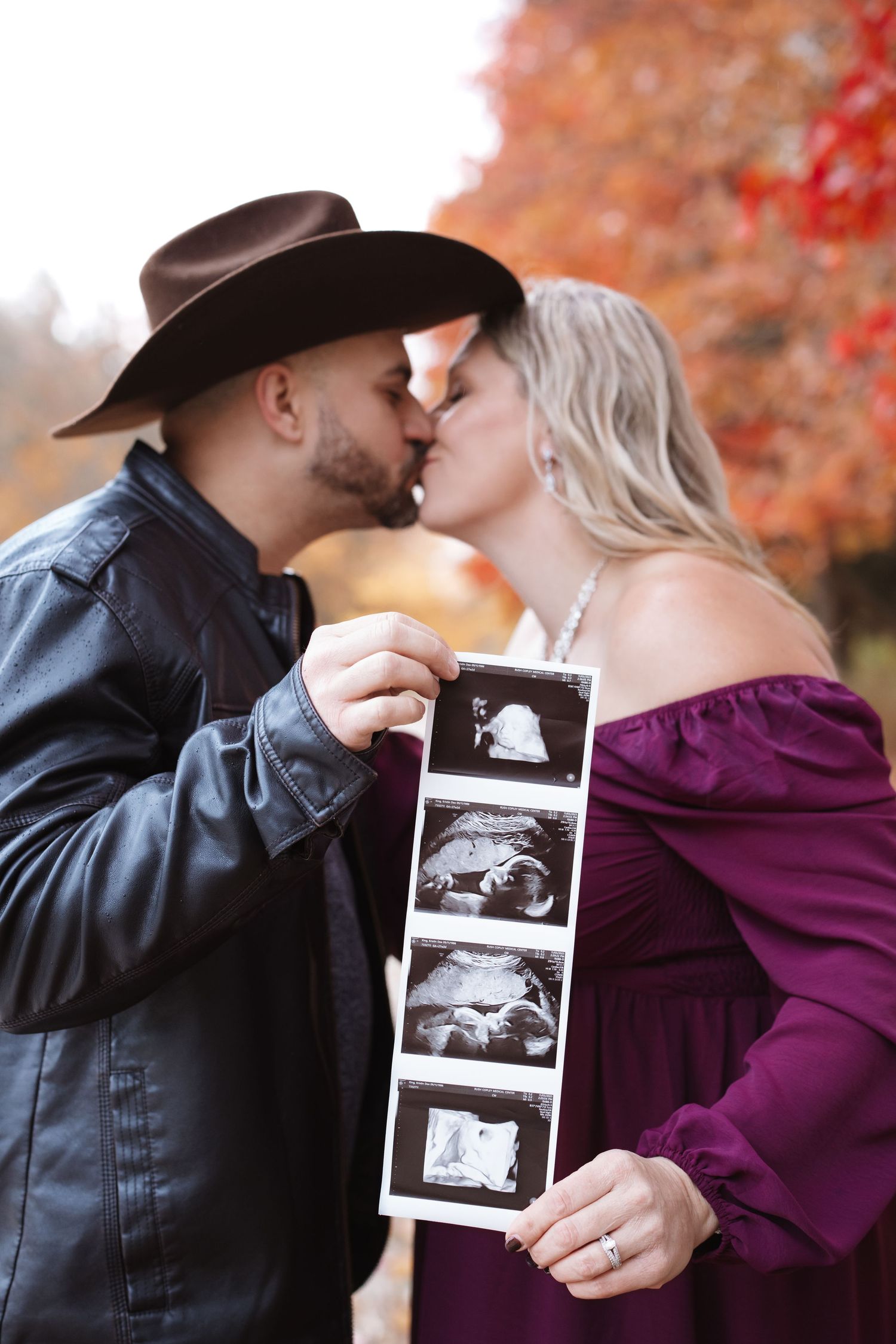 Pregnant couple shares a kiss while holding ultrasound strip in a vibrant autumn outdoor setting.