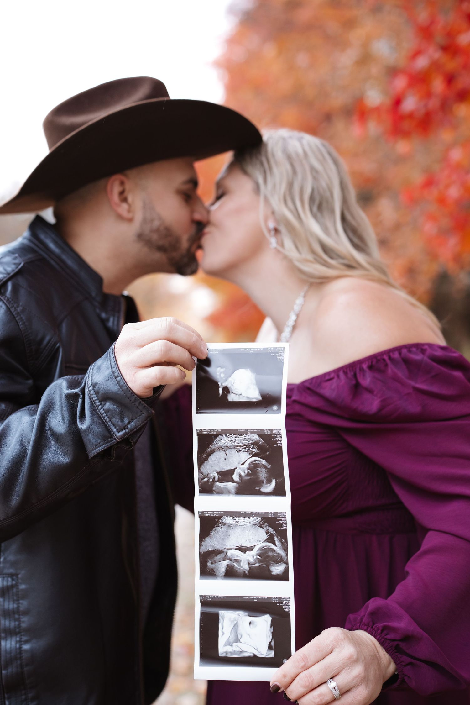 Expecting couple kisses while displaying ultrasound strip photos in colorful fall surroundings.