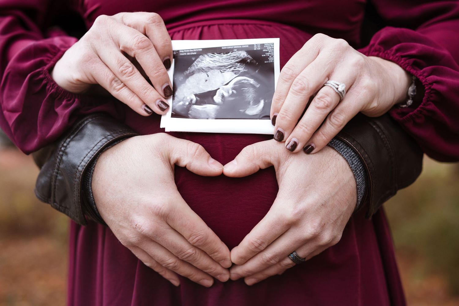 Expecting couple forming heart with hands below ultrasound photo on pregnant belly.
