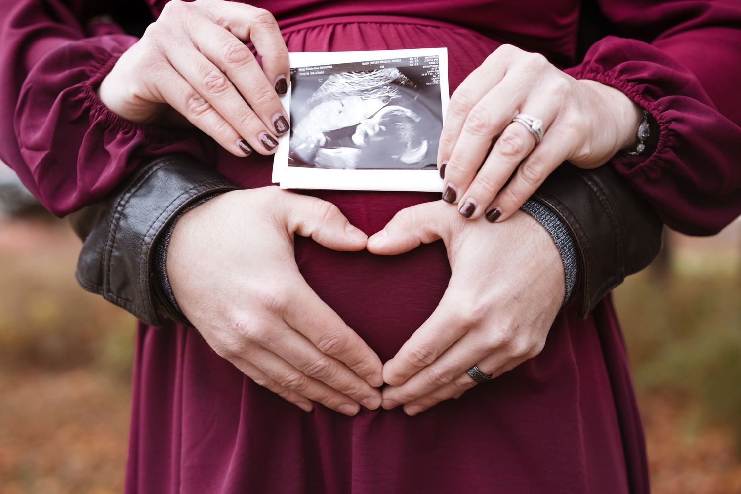 Couple displaying ultrasound photo above heart-shaped hands on pregnant belly outdoors.