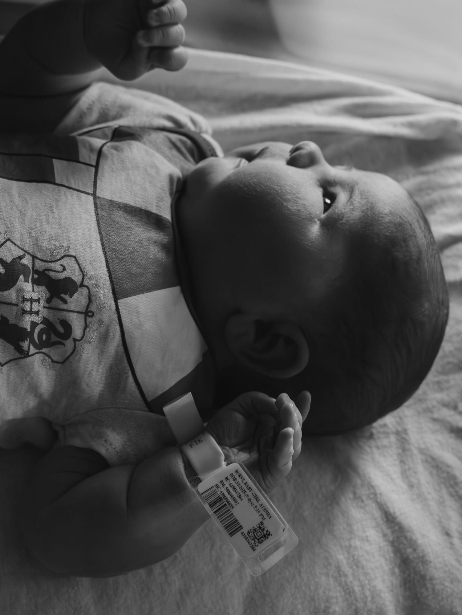 Black and white close-up medical images showing a newborn infant receiving medical care in a hospital setting.