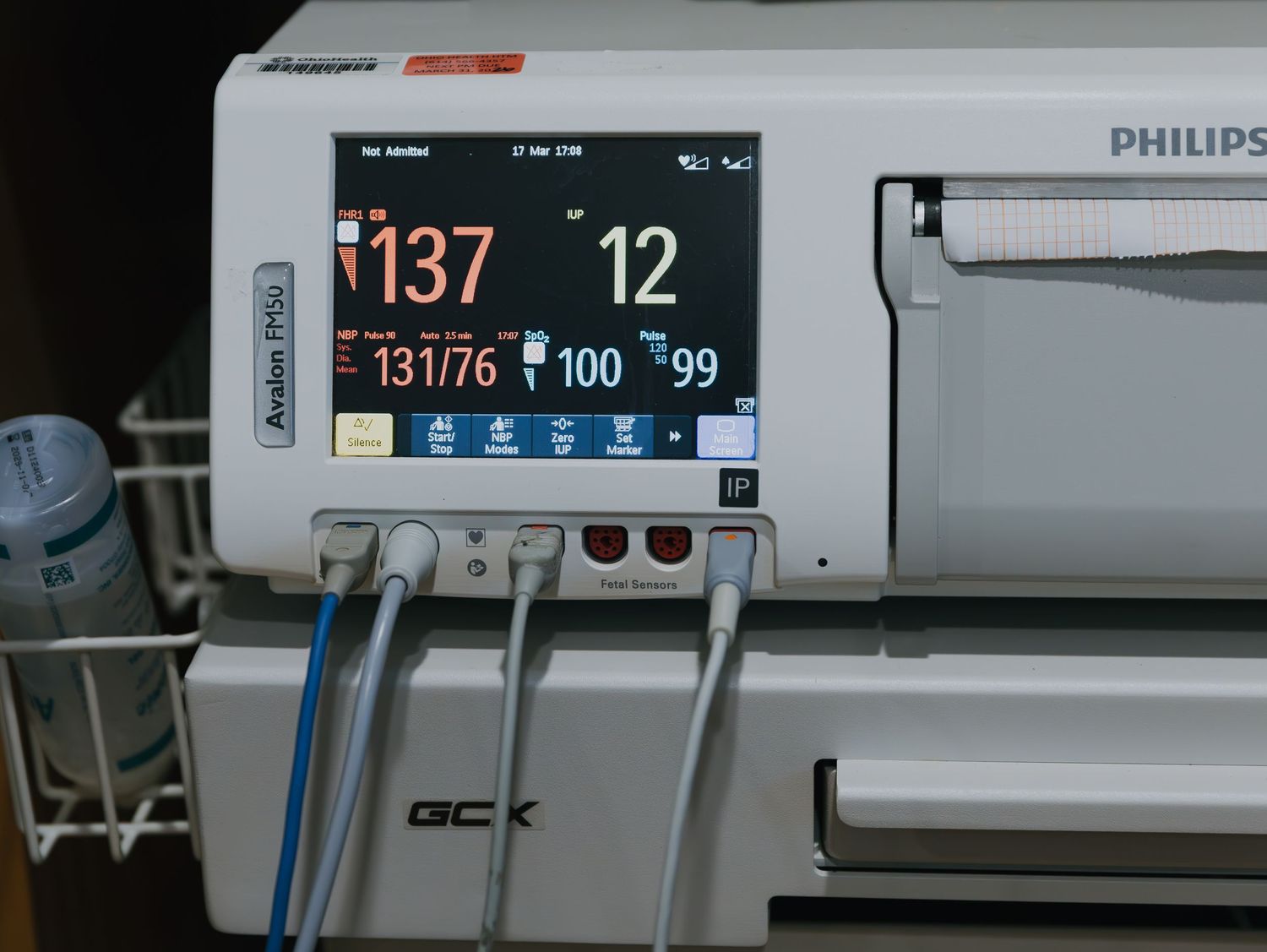 Medical monitoring device showing vital signs display with blood pressure reading of 137/12 on Philips equipment.