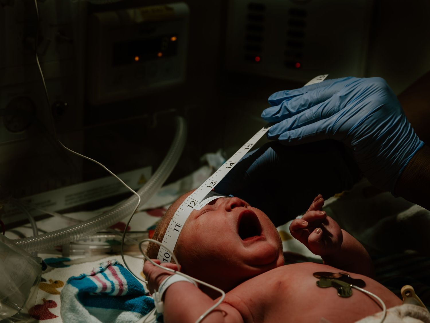 A gloved medical professional performs a procedure on a crying newborn in a hospital neonatal unit.
