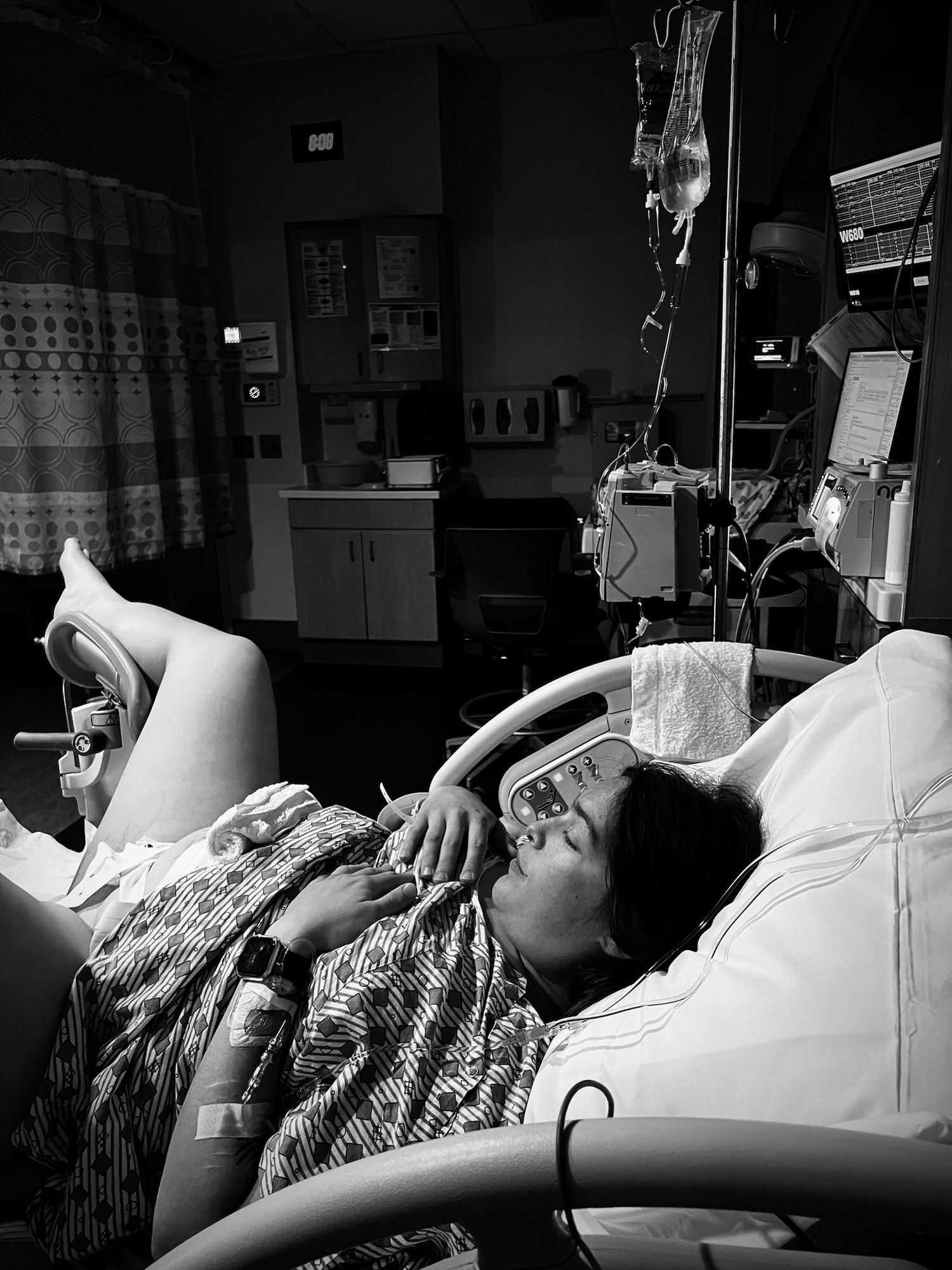 A tissue blanket and IV tubes surround a patient resting in a hospital bed.