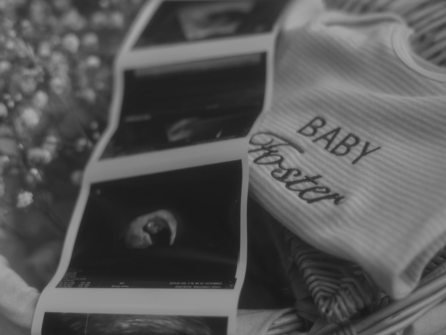 A black and white ultrasound image displayed alongside baby clothing and pregnancy announcement items.