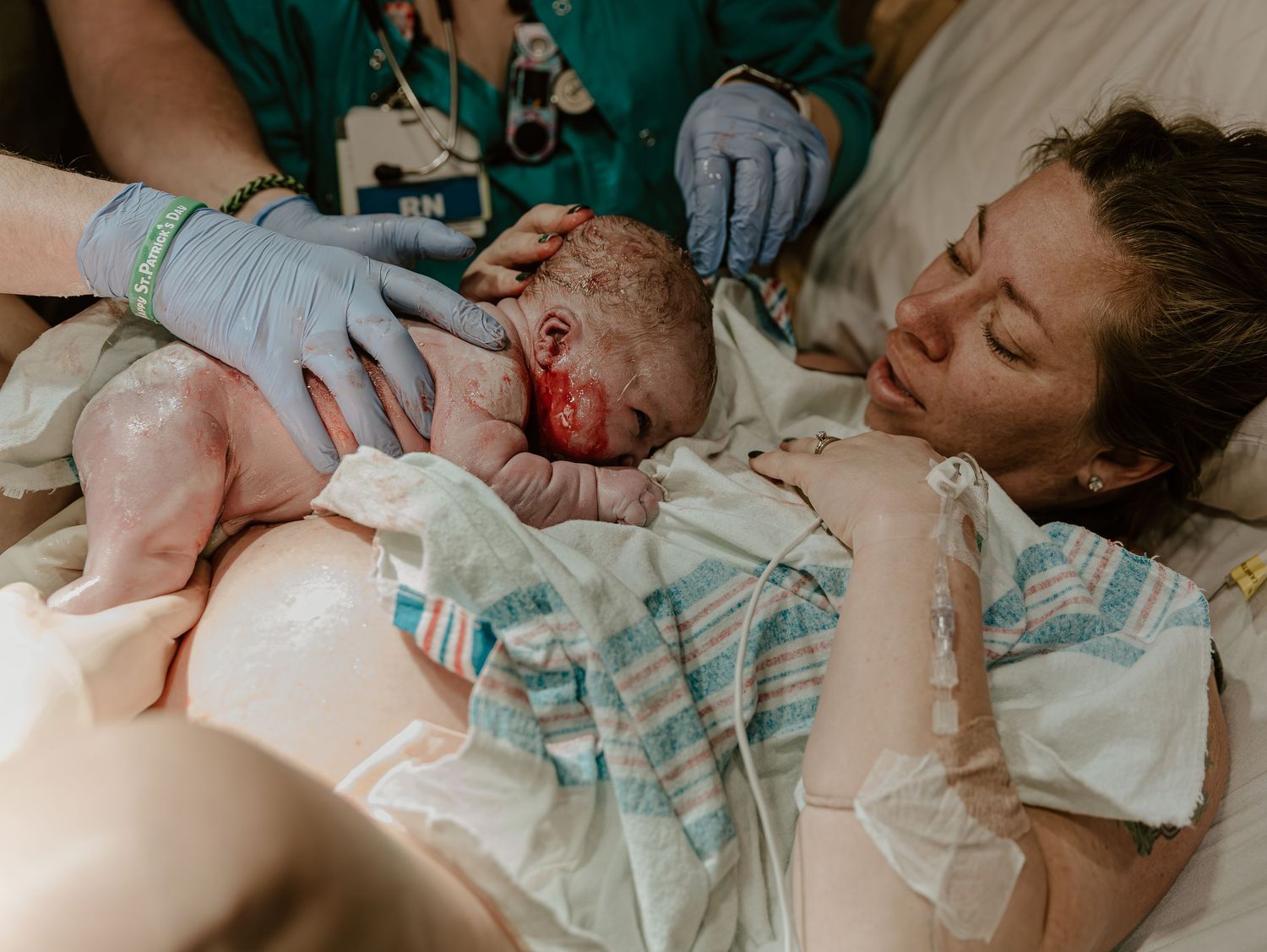 Medical staff in blue gloves places newborn baby on parent's chest immediately after birth in hospital setting.