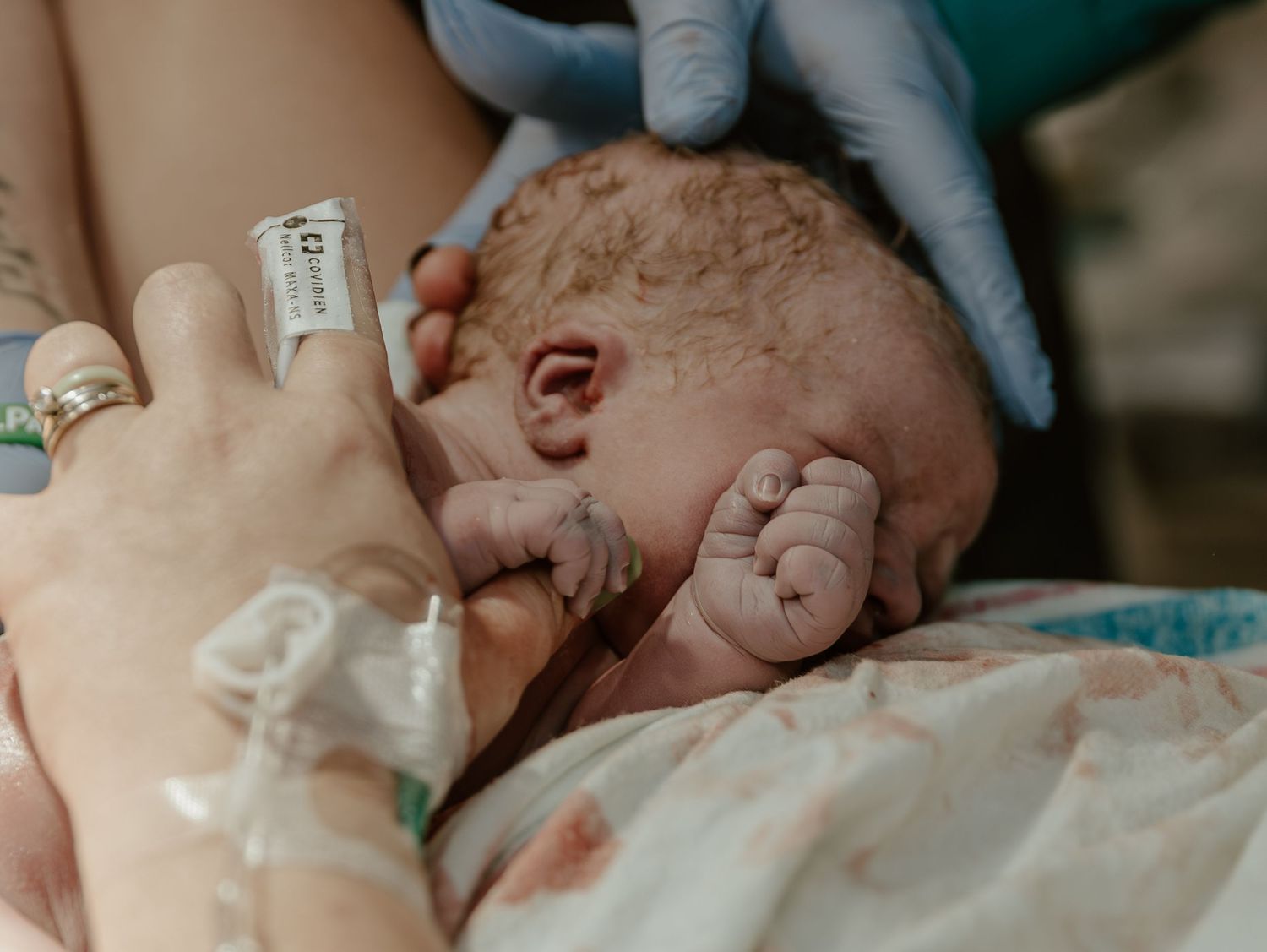 Medical professionals assist a newborn baby lying on a hospital blanket during first moments after birth.