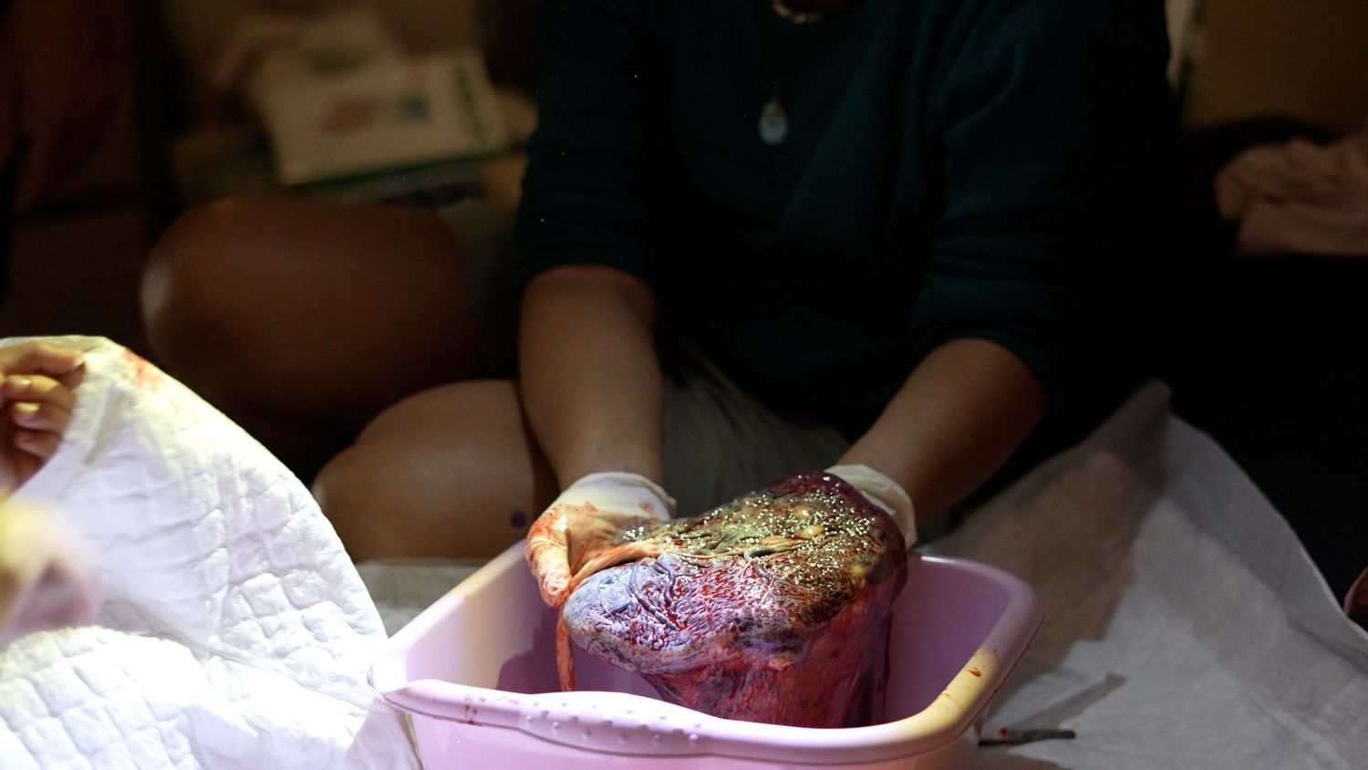 Placenta