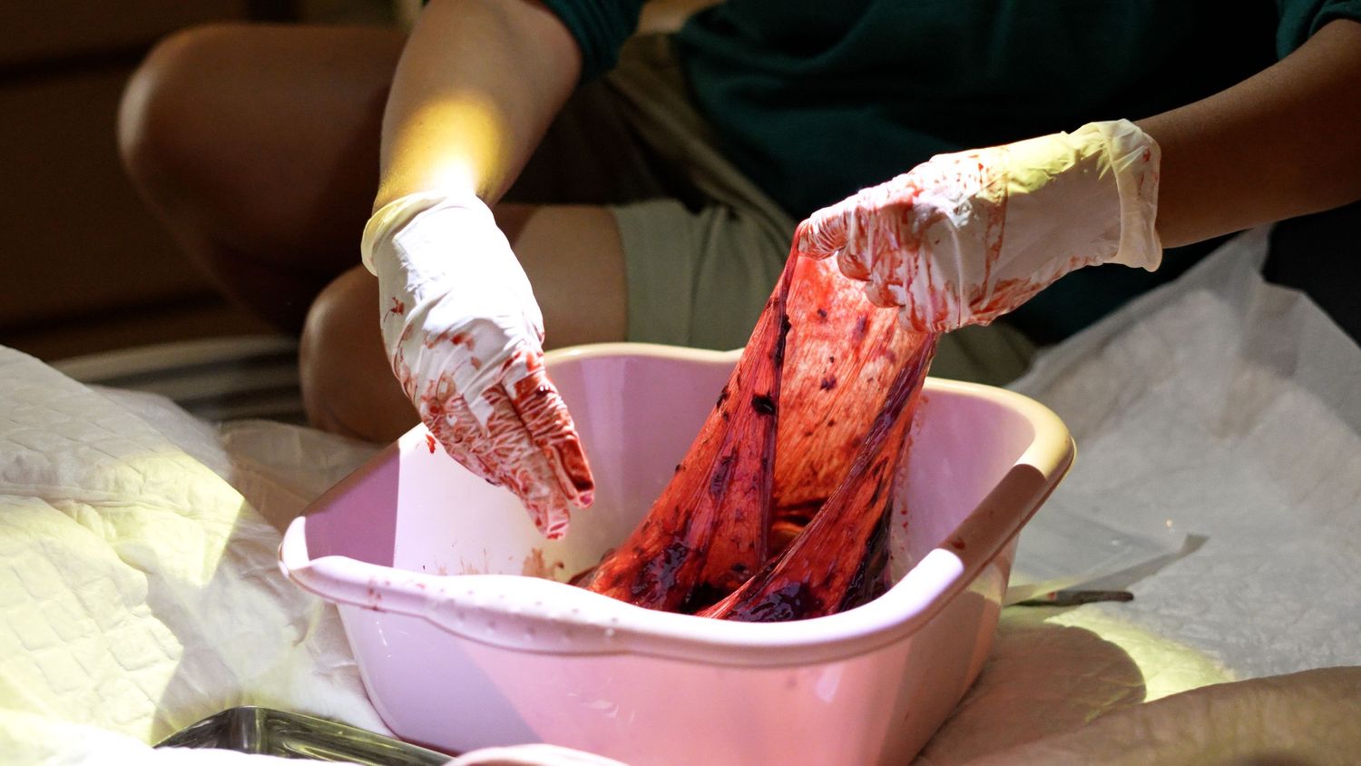 Placenta