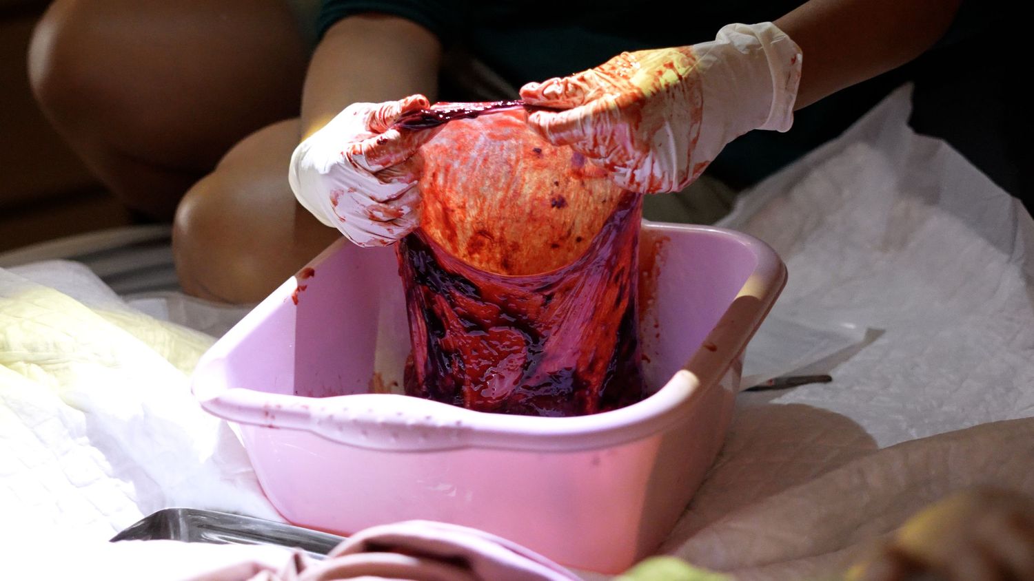 Placenta