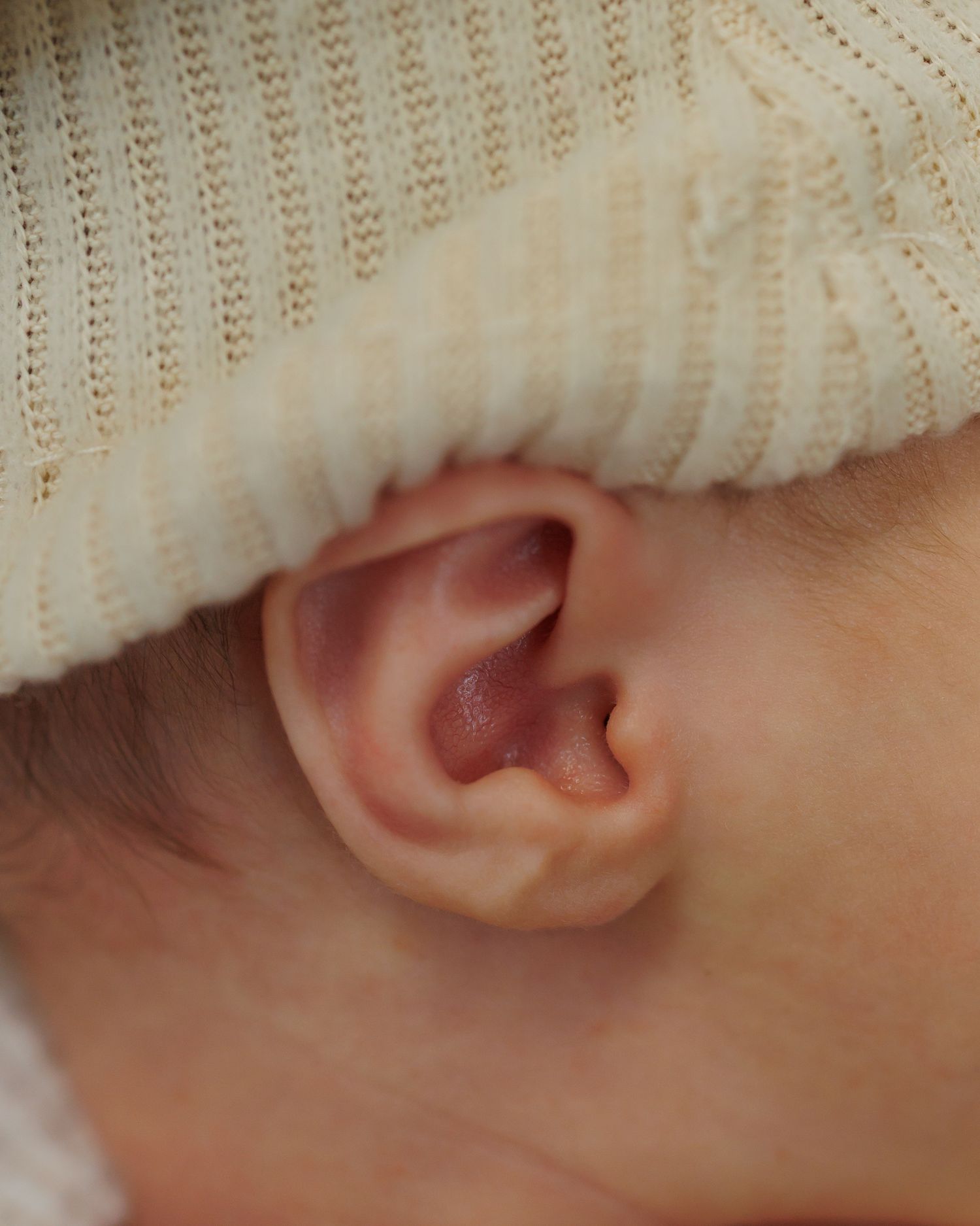 Close-up macro photograph showing a series of human ears in a horizontal row against a light background.