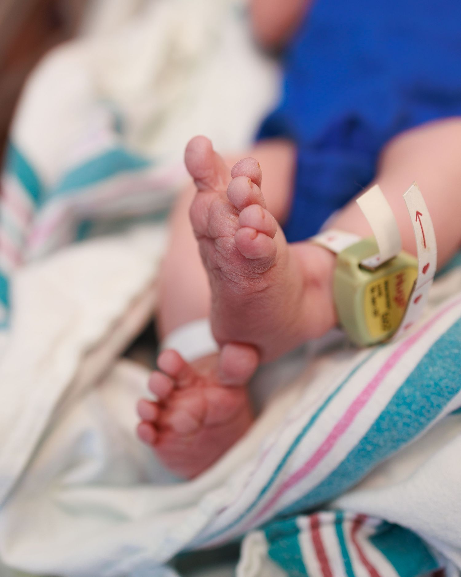 Tiny newborn baby feet resting on a striped hospital blanket with medical equipment visible in background.