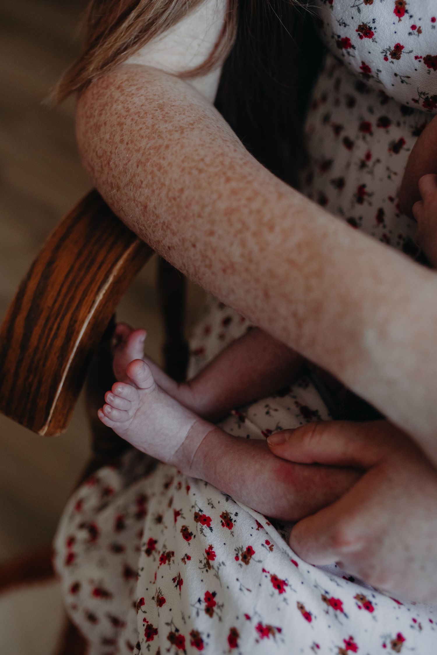 Close-up sequence of freckled arms in a floral dress showing self-harm scars healing over time.