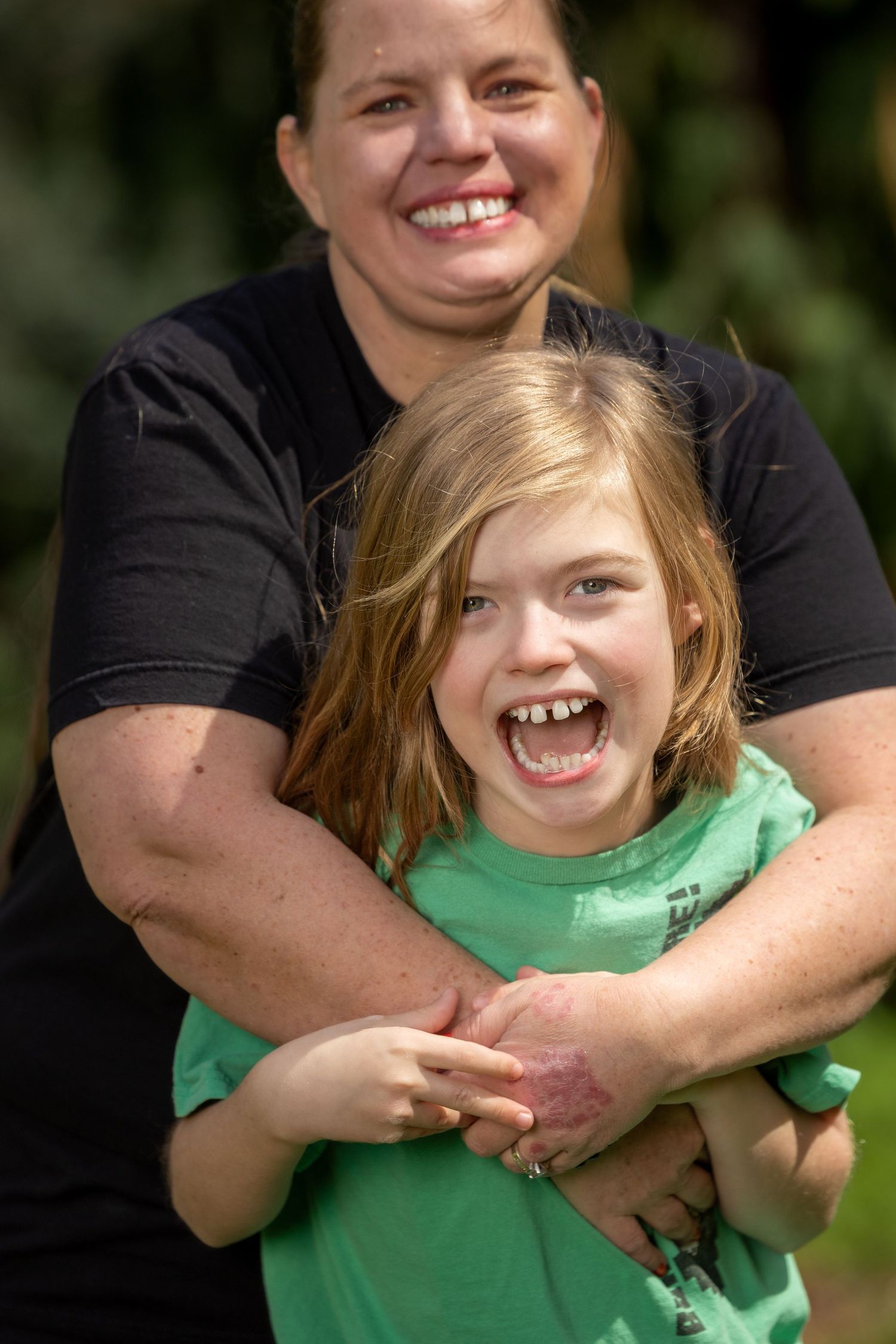 Candid moment of pure joy captured between parent and child outdoors.