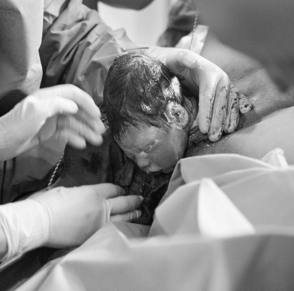 newborn baby being born during natural birth in hospital