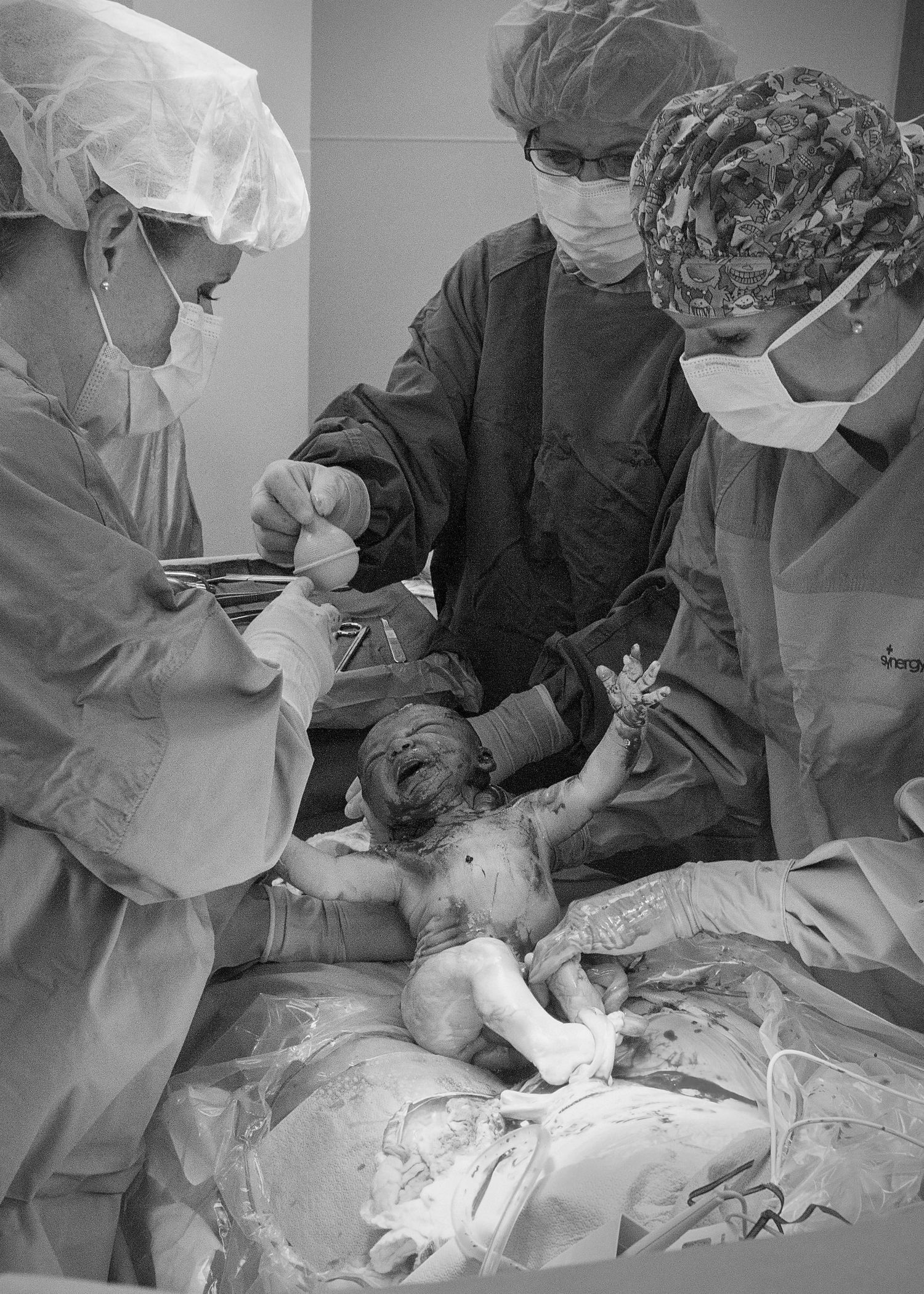 doctor lifting newborn baby during c section birth photography