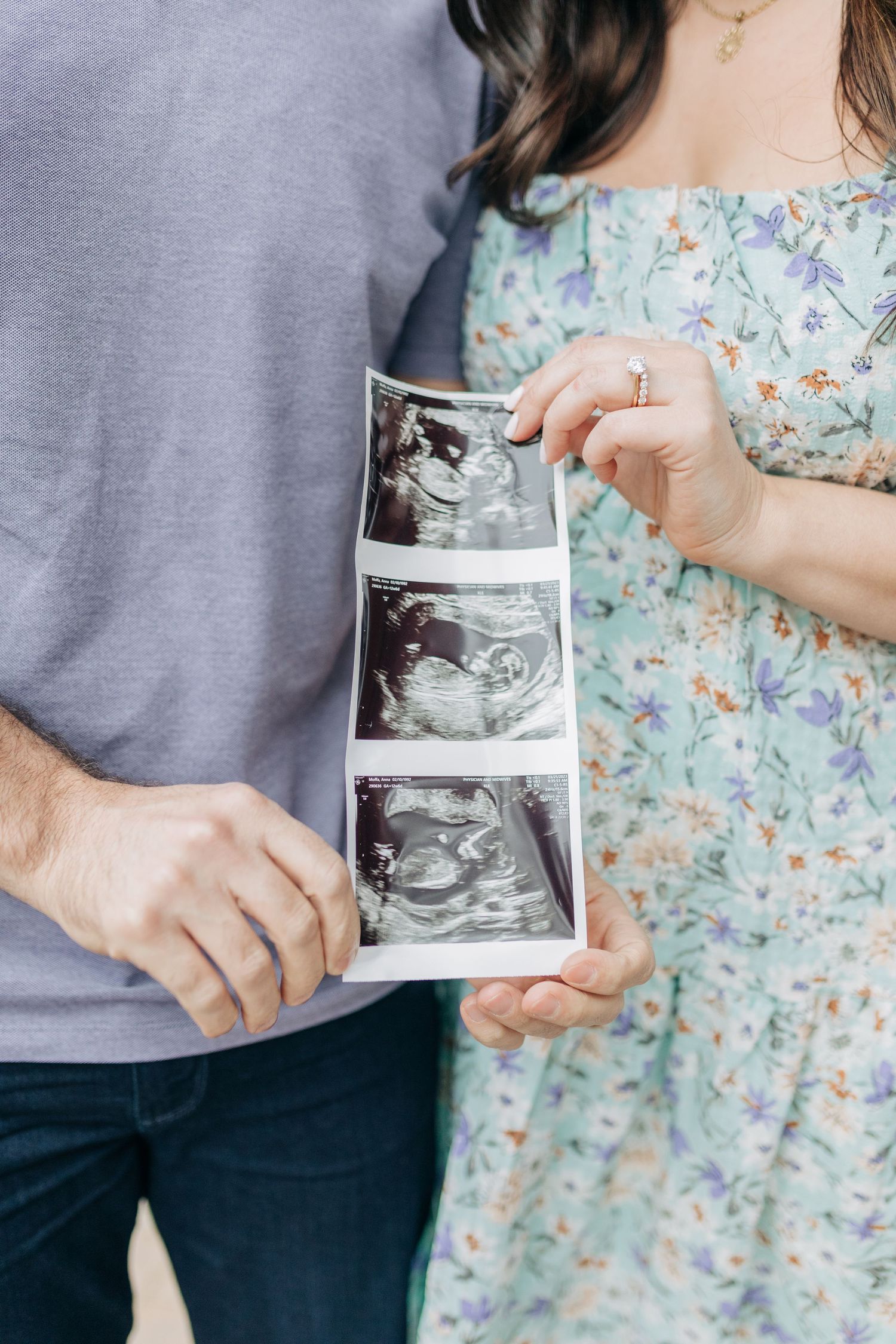 Close-up of hands holding black and white ultrasound photos against floral dress fabric.